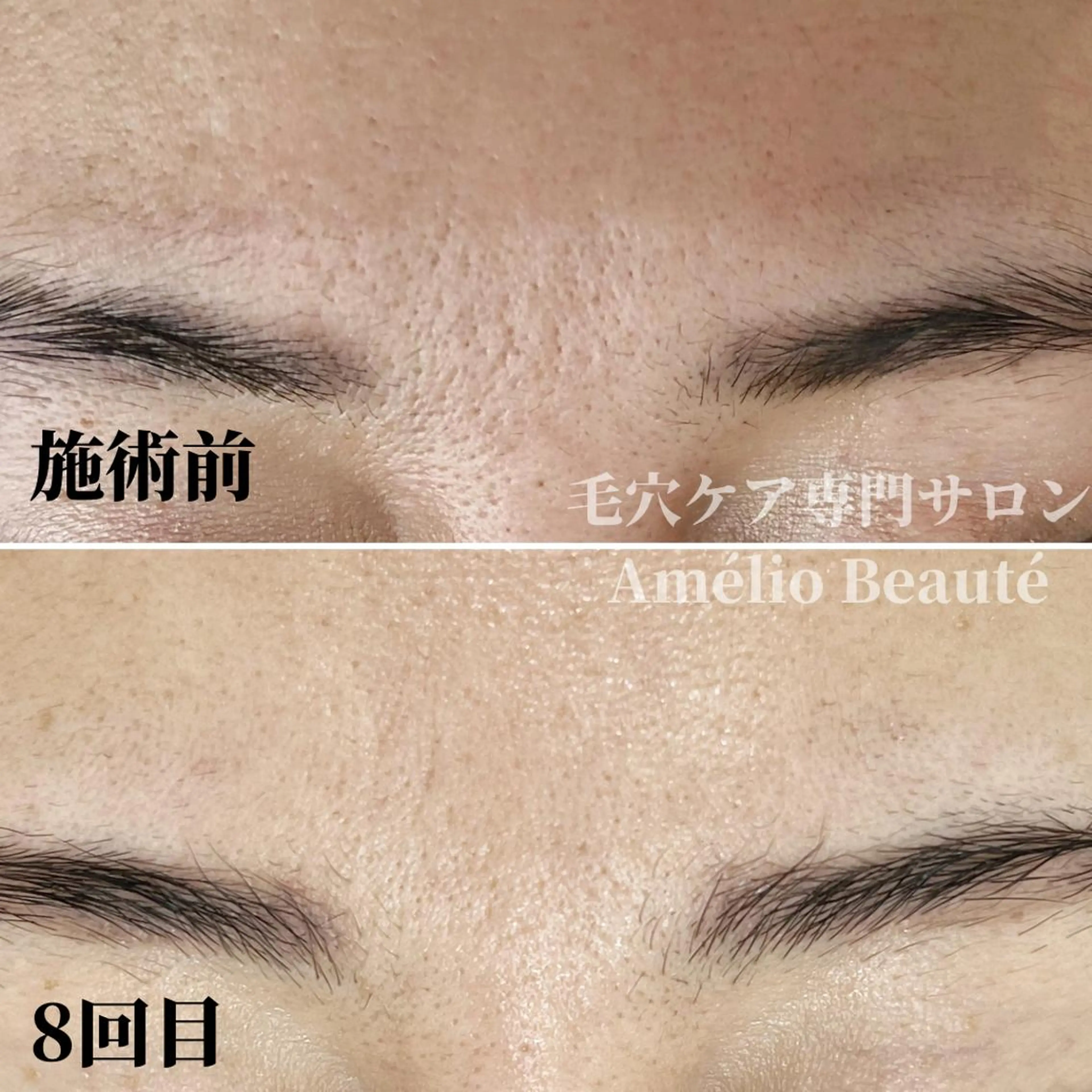 毛穴ケア専門サロン Amélio Beauté所属・毛穴ケア専門サロン アメリオボーテのその他イメージ