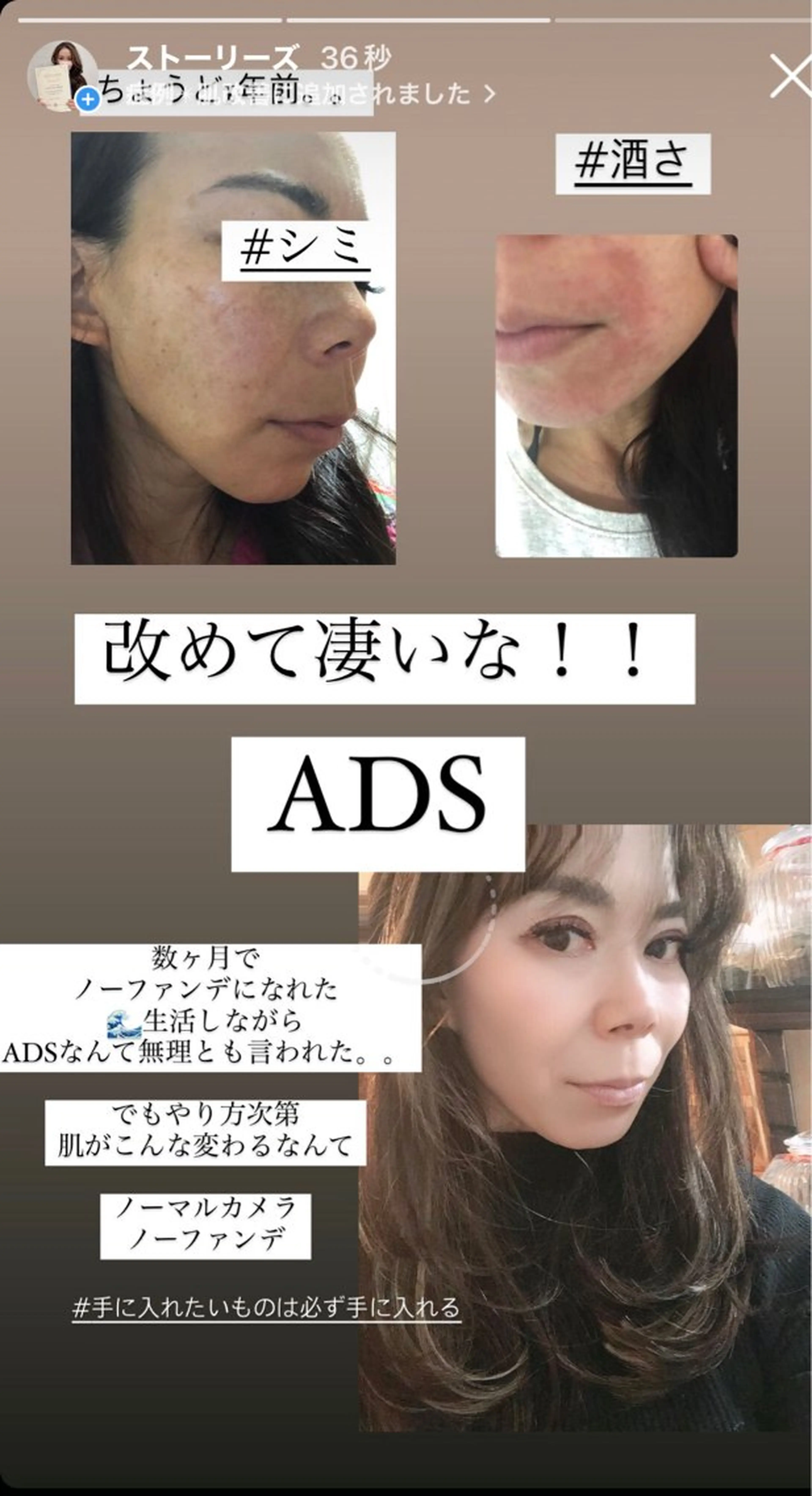 private salon  Dea_maris シュガーリング＆パーソナルボディケア所属・シミ改善・韓国肌管理 ボディメイク痩身のその他イメージ