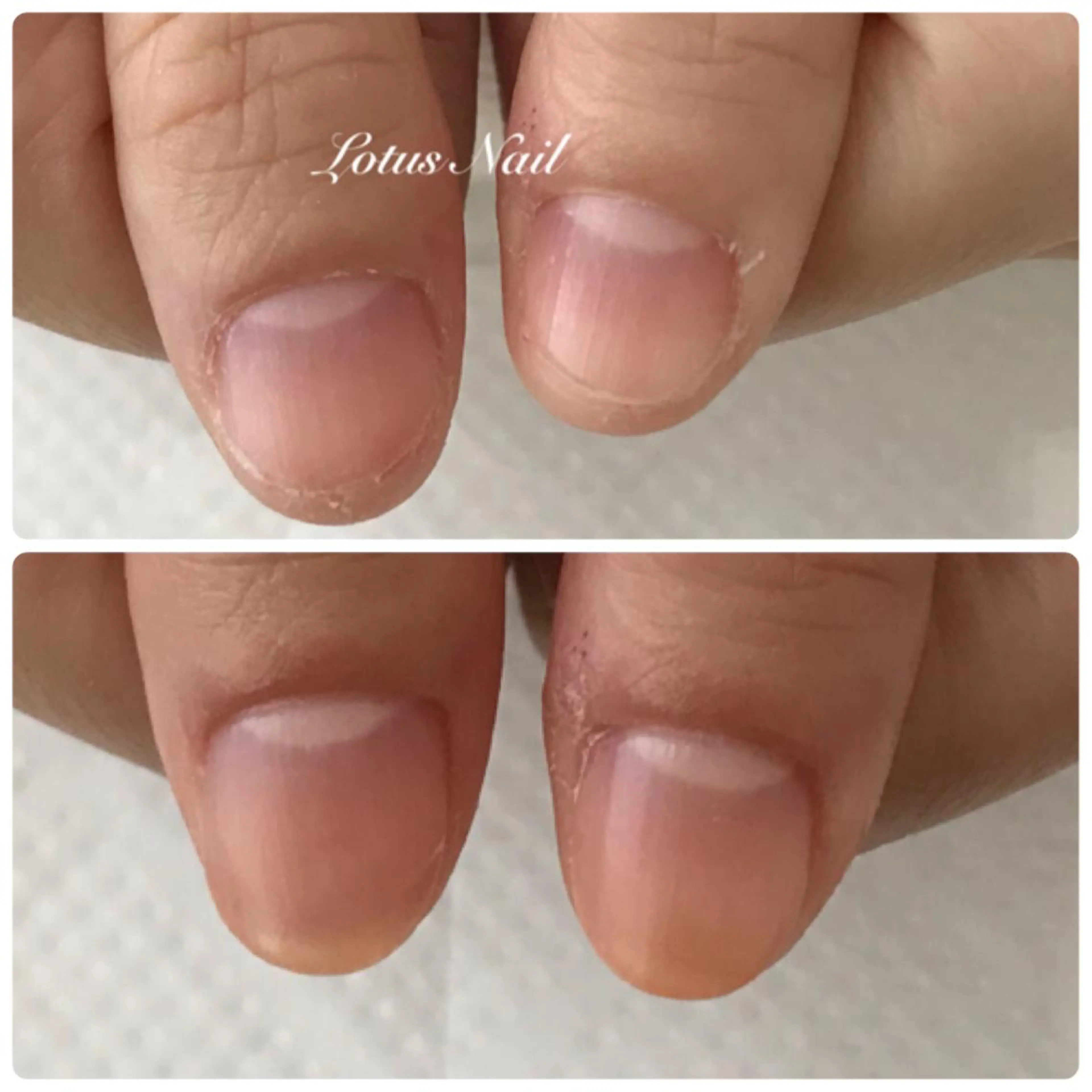 ネイル ハンドネイル Lotus Nailのネイルデザイン