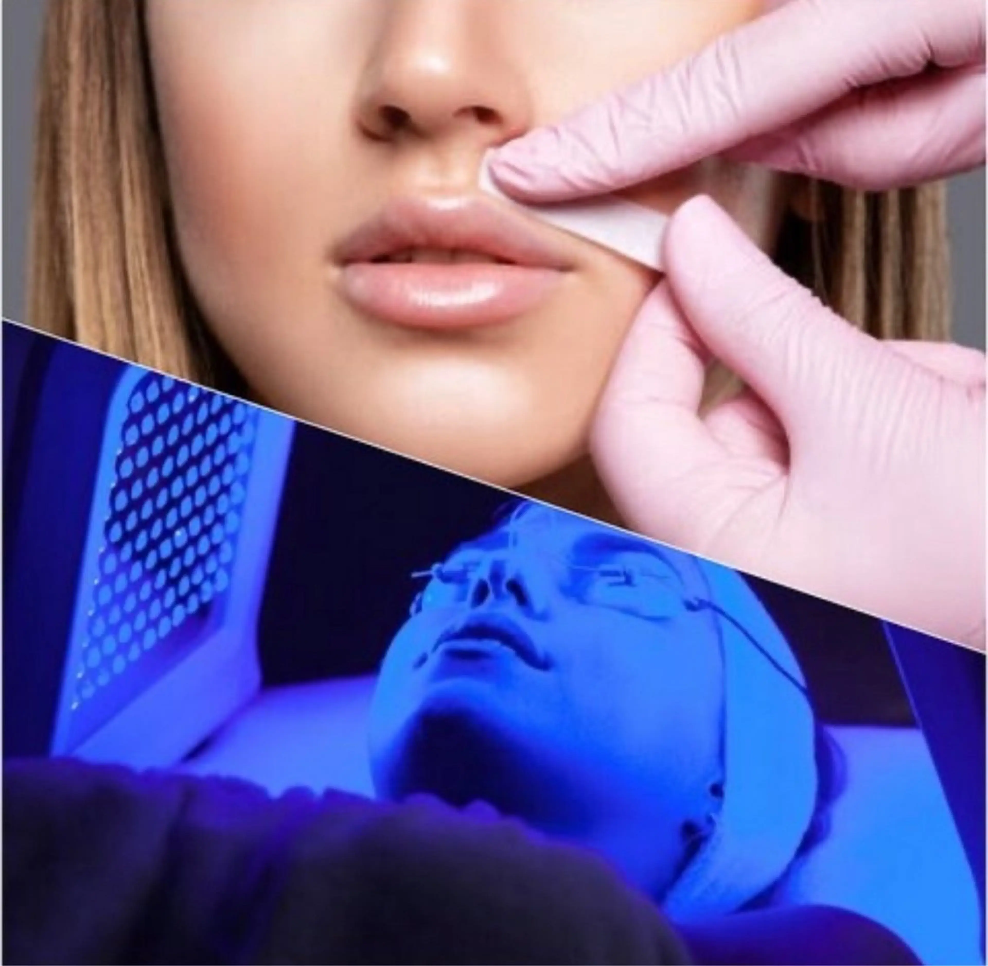 【12月末まで】うる艶水光肌♪艶肌FaceWax脱毛＋韓国LEDパック付【モニター特別価格】の写真