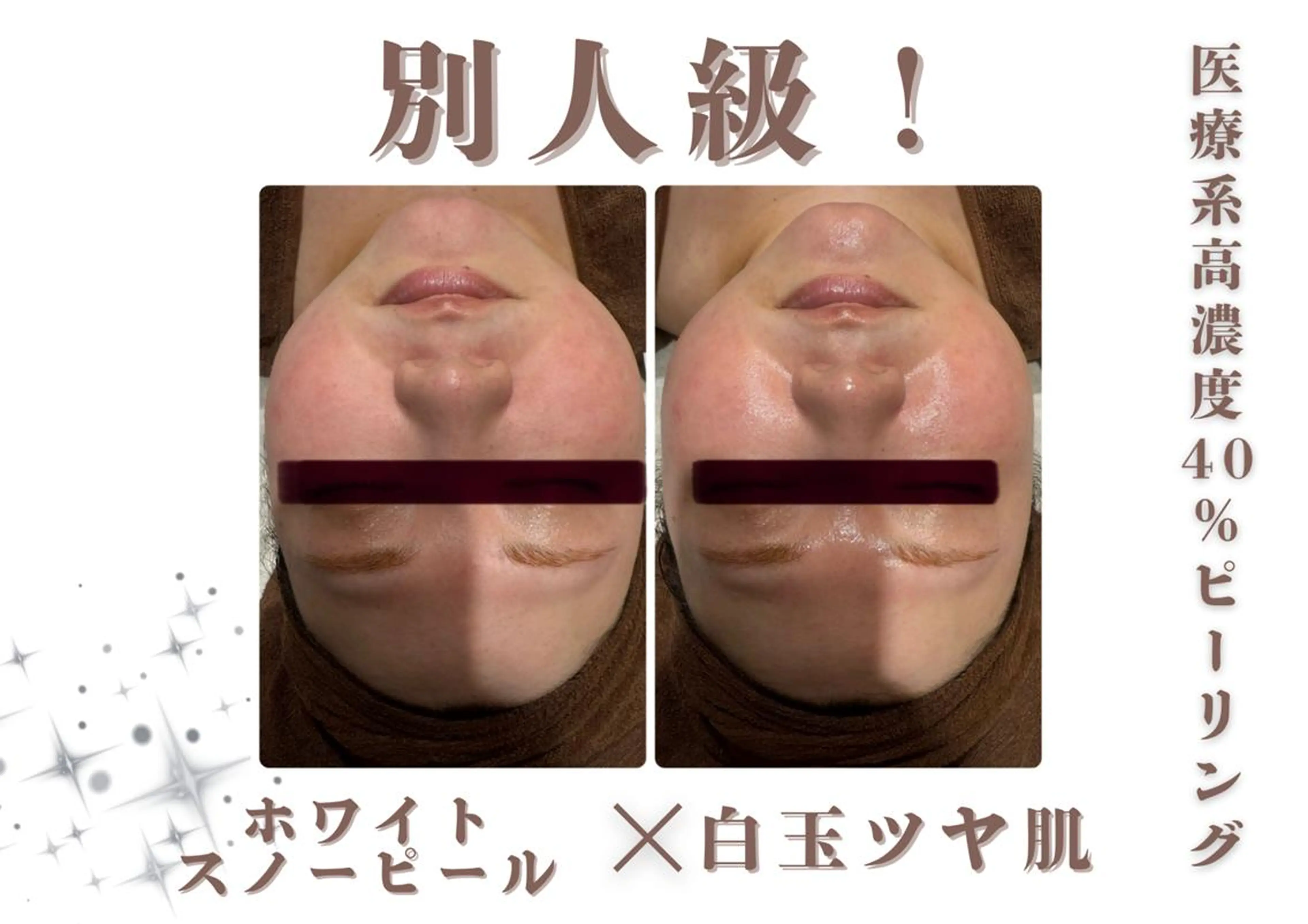 エステ 🎀美肌ケアサロン 🎀レイビス銀座店のエステ・リラクイメージ