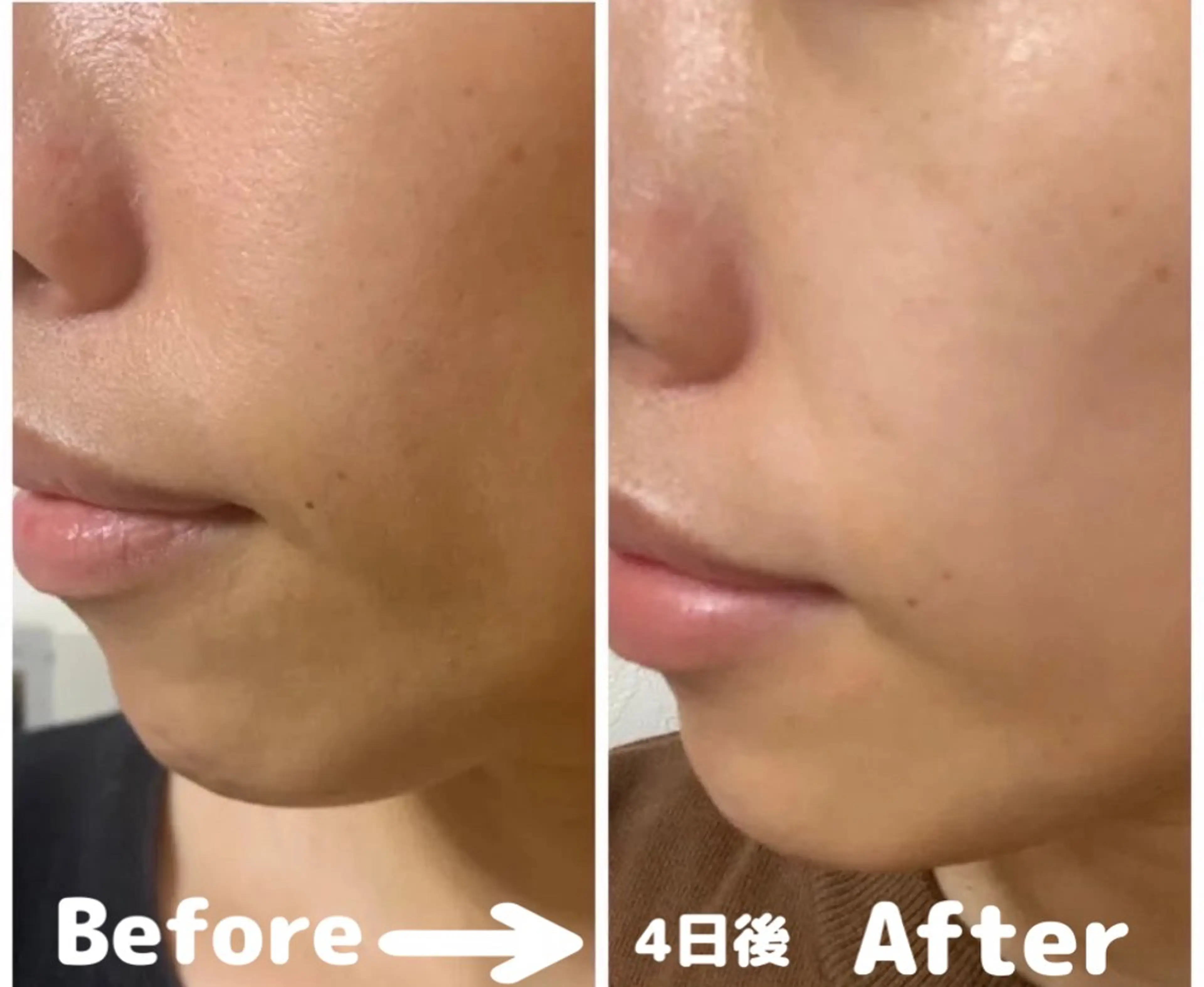 エステ リラク ANABEL+所属・せと ななほ🫧のエステ・リラクイメージ