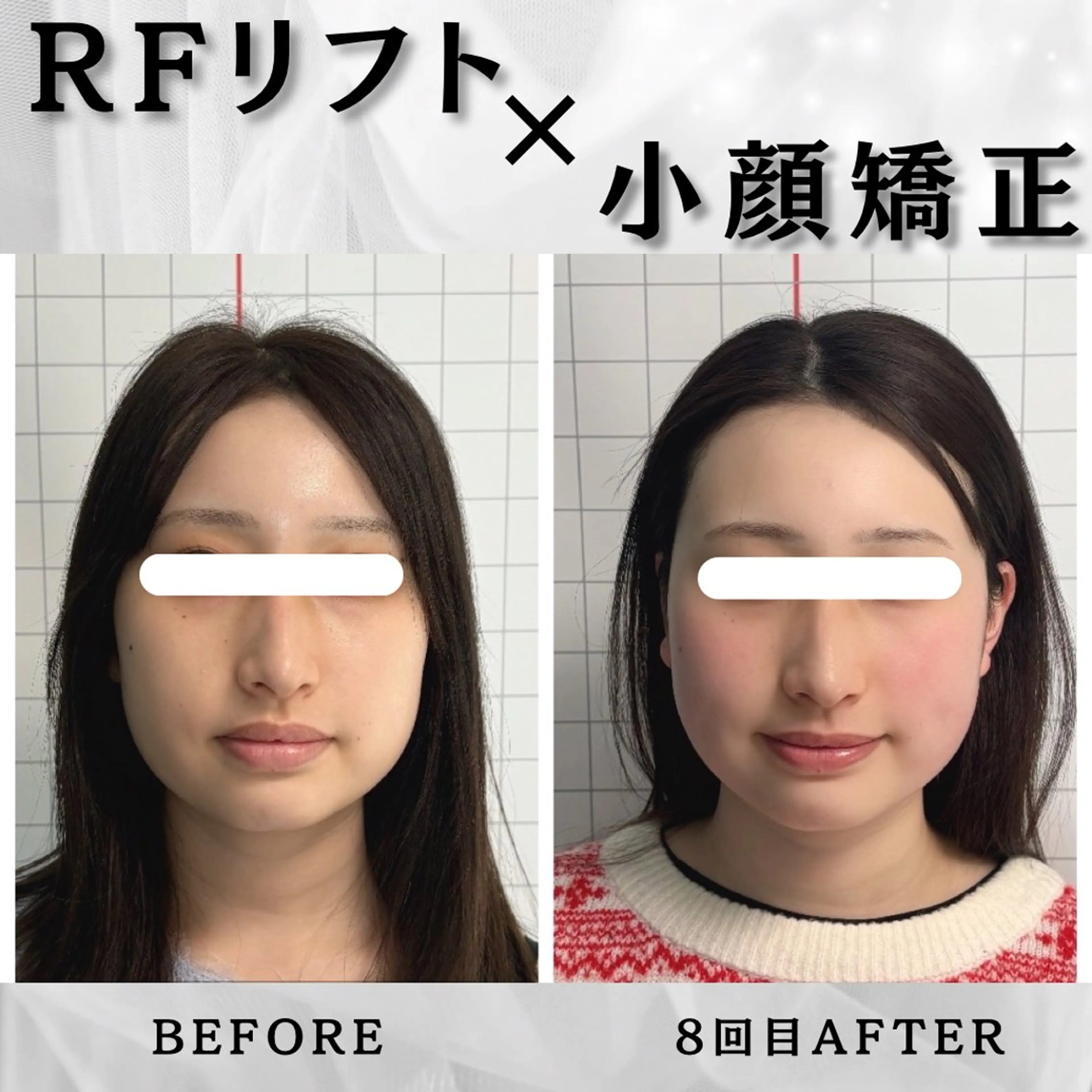 エステ リラク 小顔矯正専門店 【RED】池田のエステ・リラクイメージ