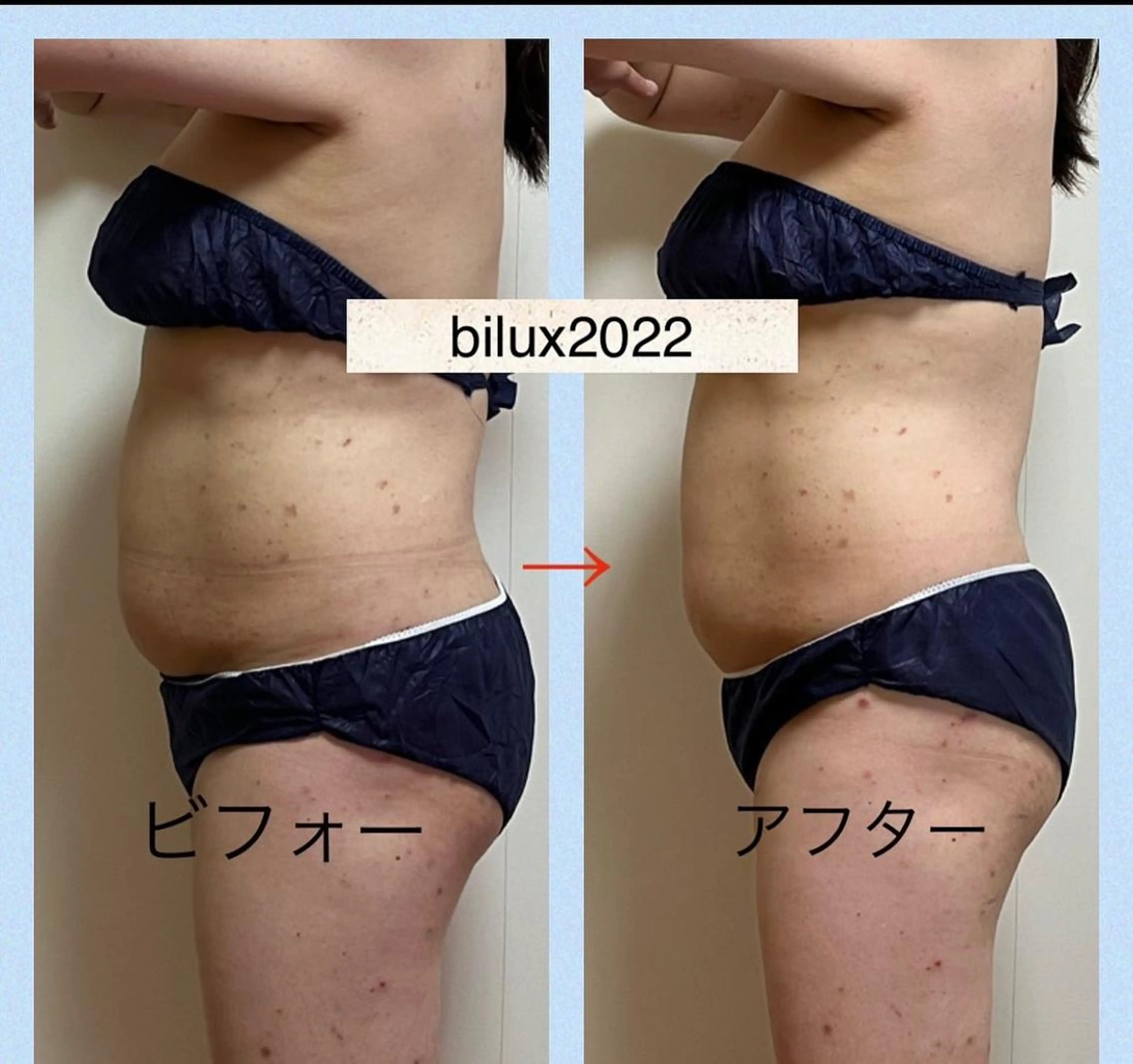 エステ my.beautytime所属・ひやね まゆみのエステ・リラクイメージ