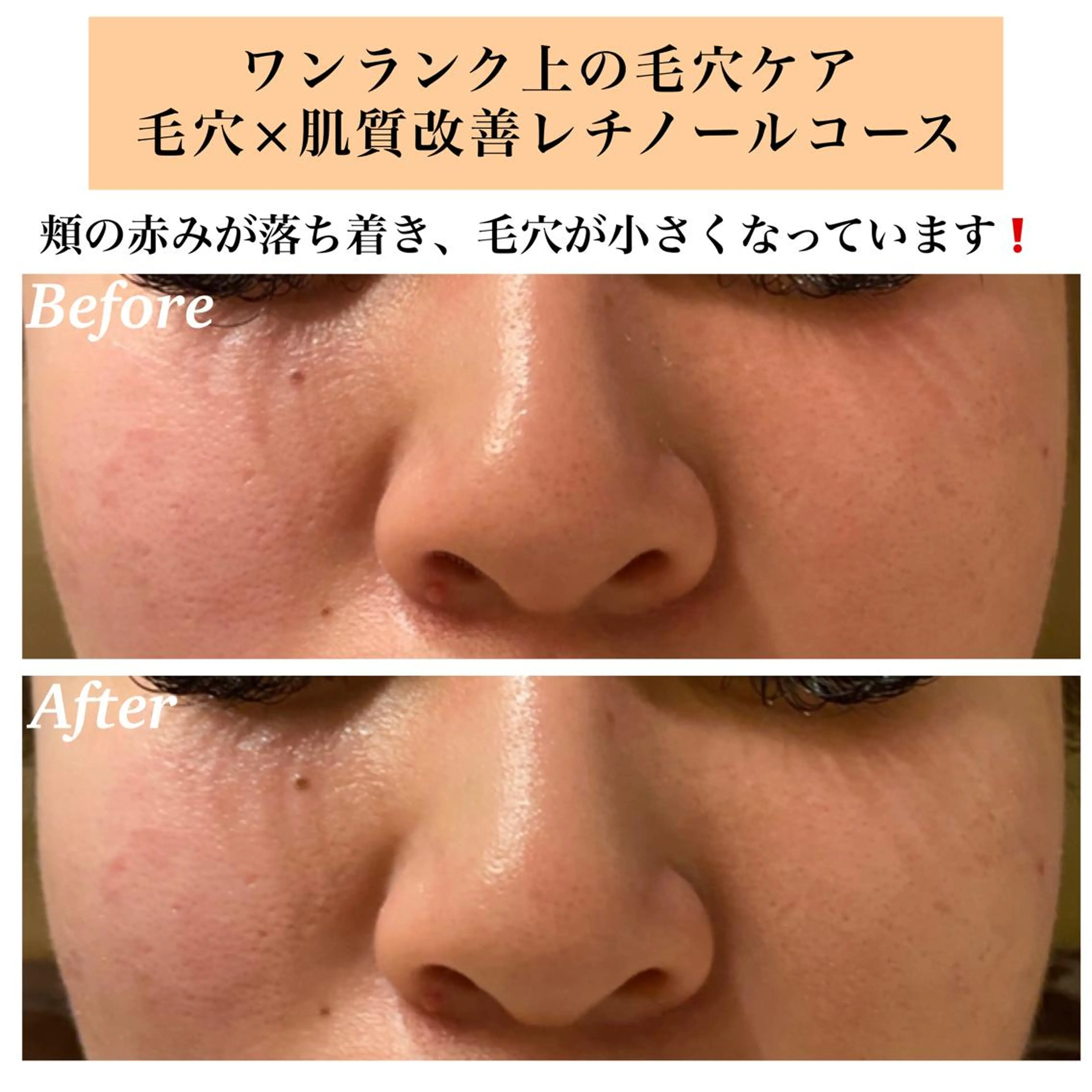 エステ リラク Bellesthe （ベルエステ）のエステ・リラクイメージ