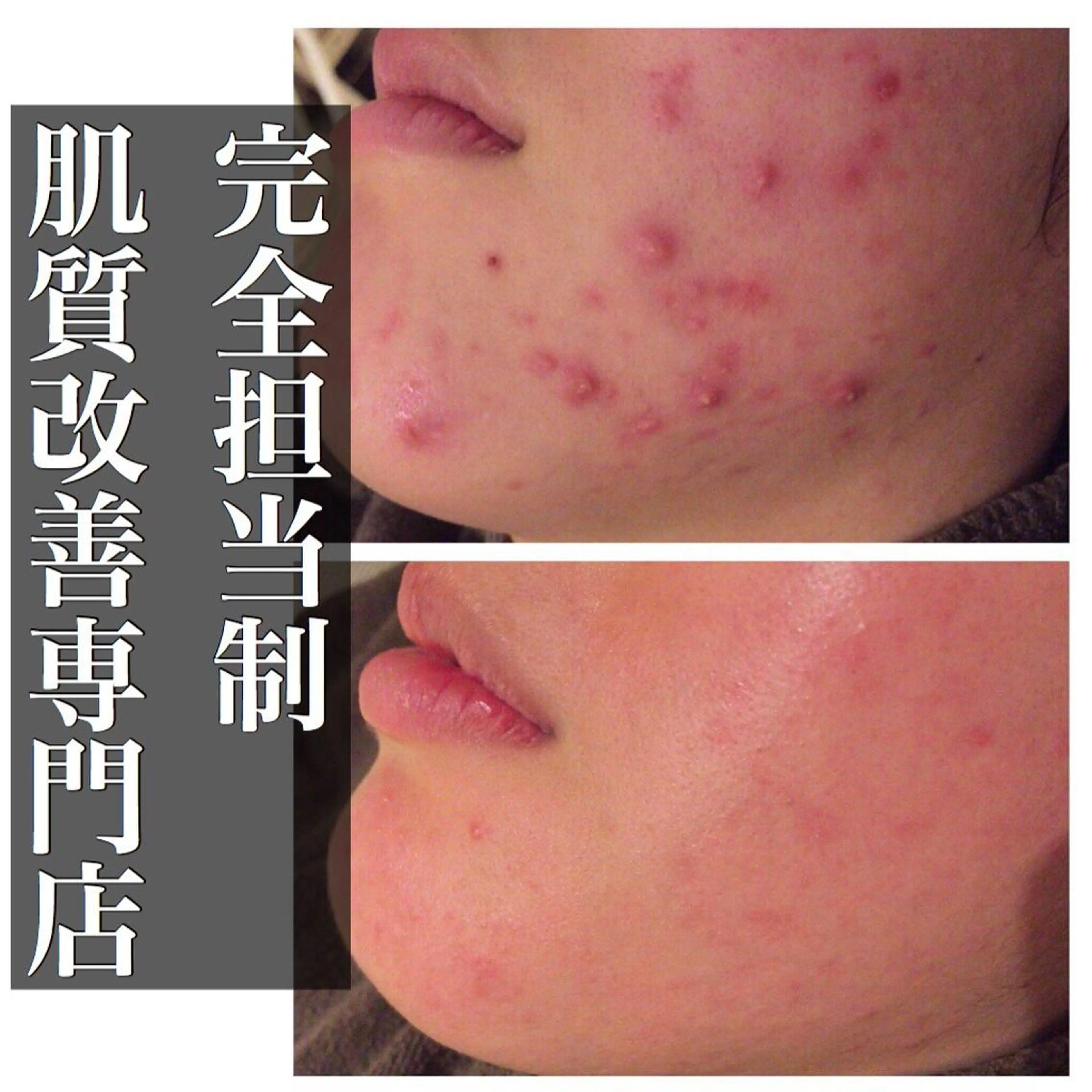 ミディアム カラー パーマ ヘアアレンジ メンズ キッズ ネイル マツエク・マツパ エステ リラク ニキビ・肌質改善専門 ♡人生が変わるサロンのエステ・リラクイメージ