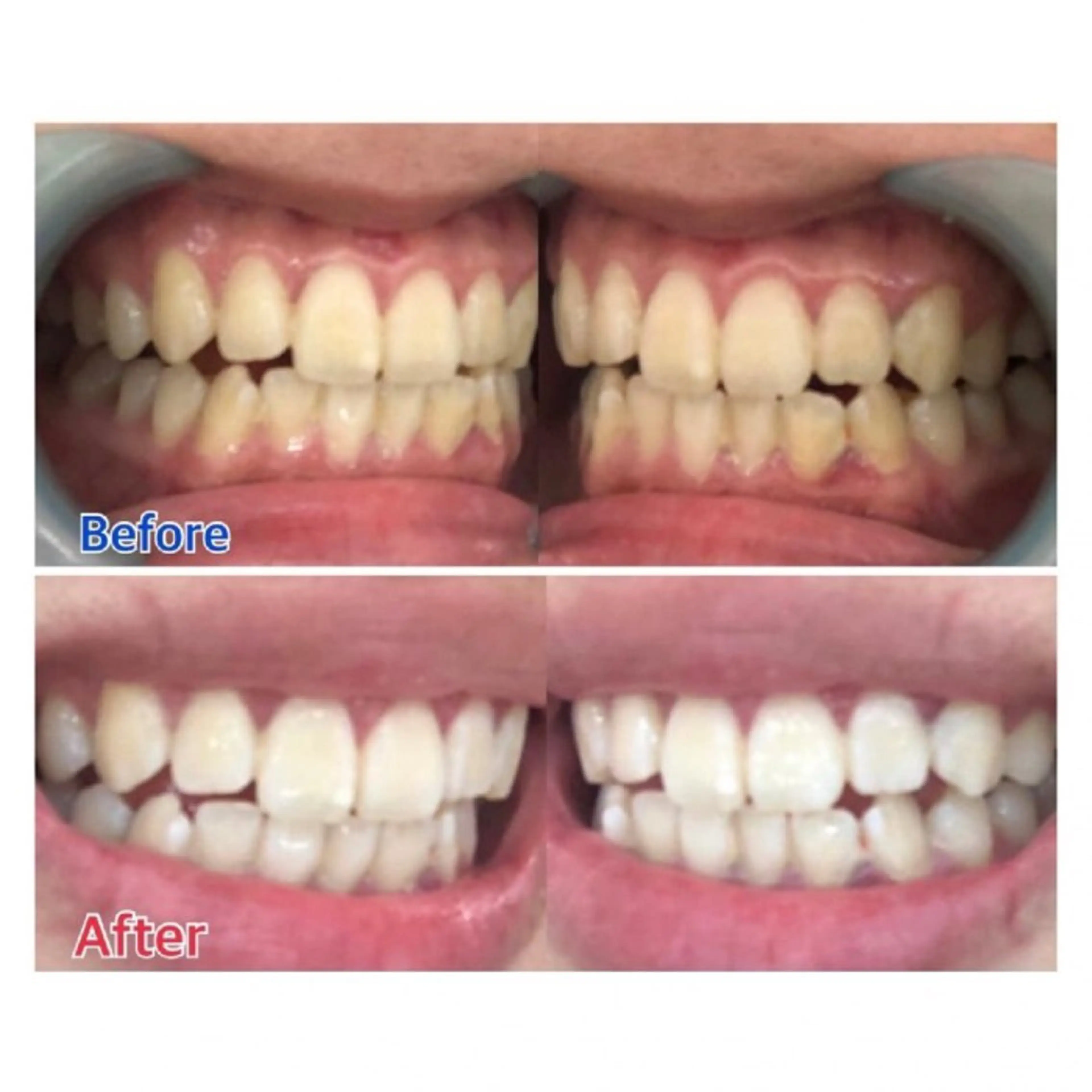 M渋谷店所属・Ｍ渋谷 ホワイトニングのエステ・リラクイメージ