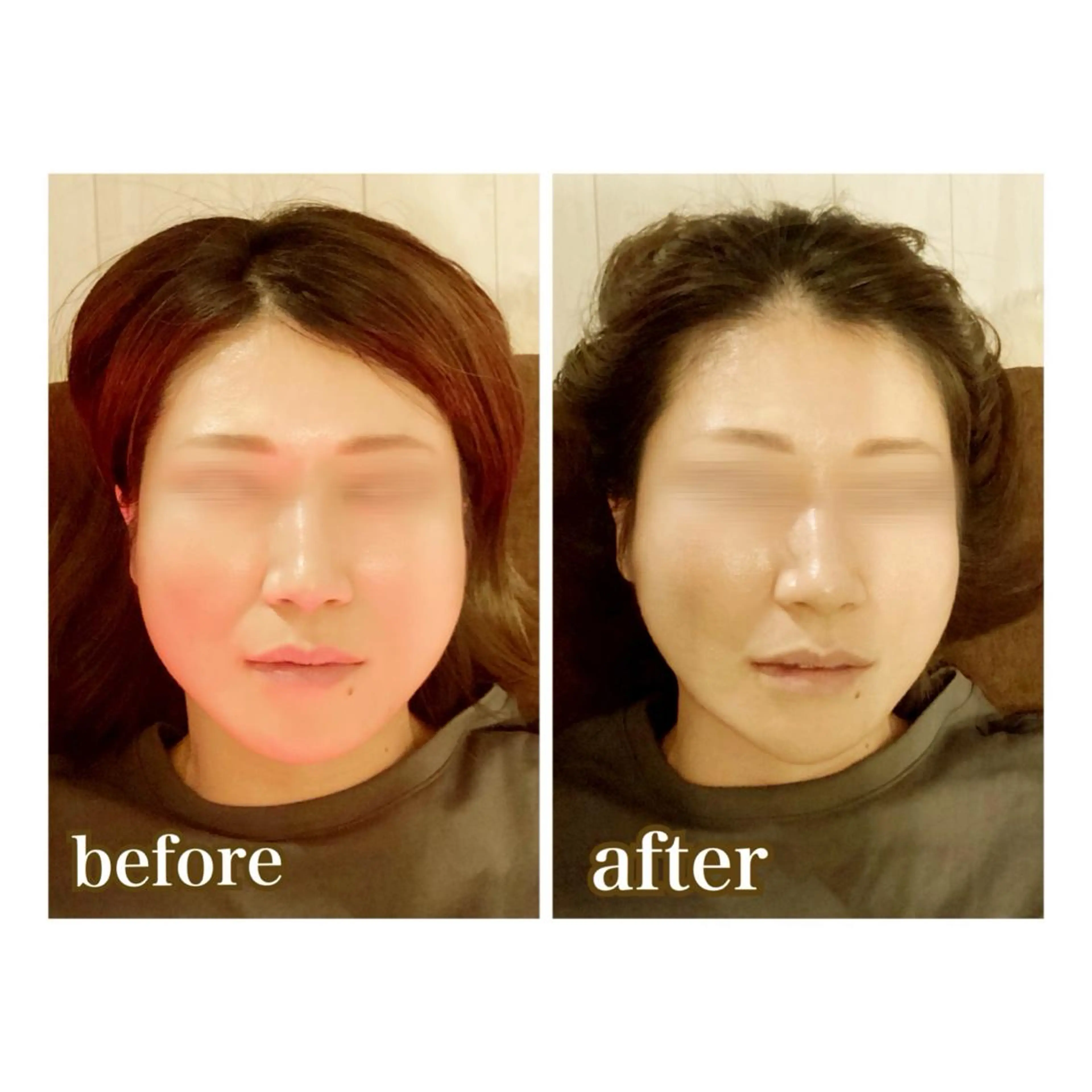 美腸専門 漢方よもぎ蒸しのエステ・リラクイメージ