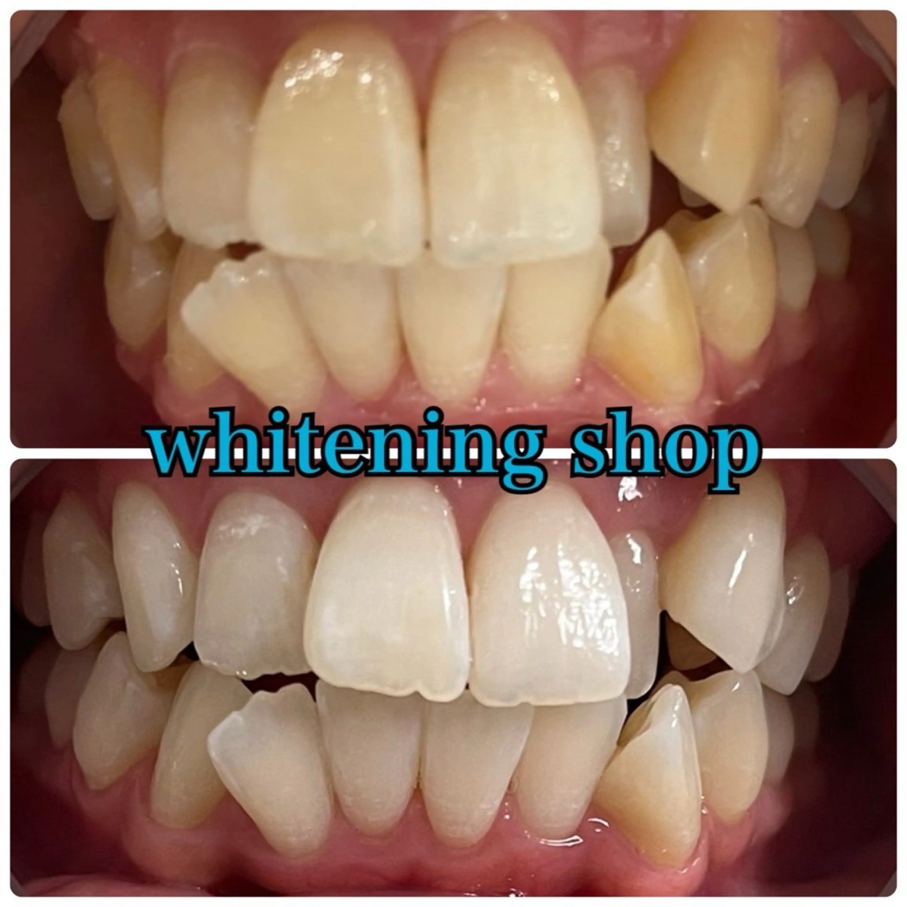 メンズ エステ リラク ホワイトニング ショップ川越店のエステ・リラクイメージ