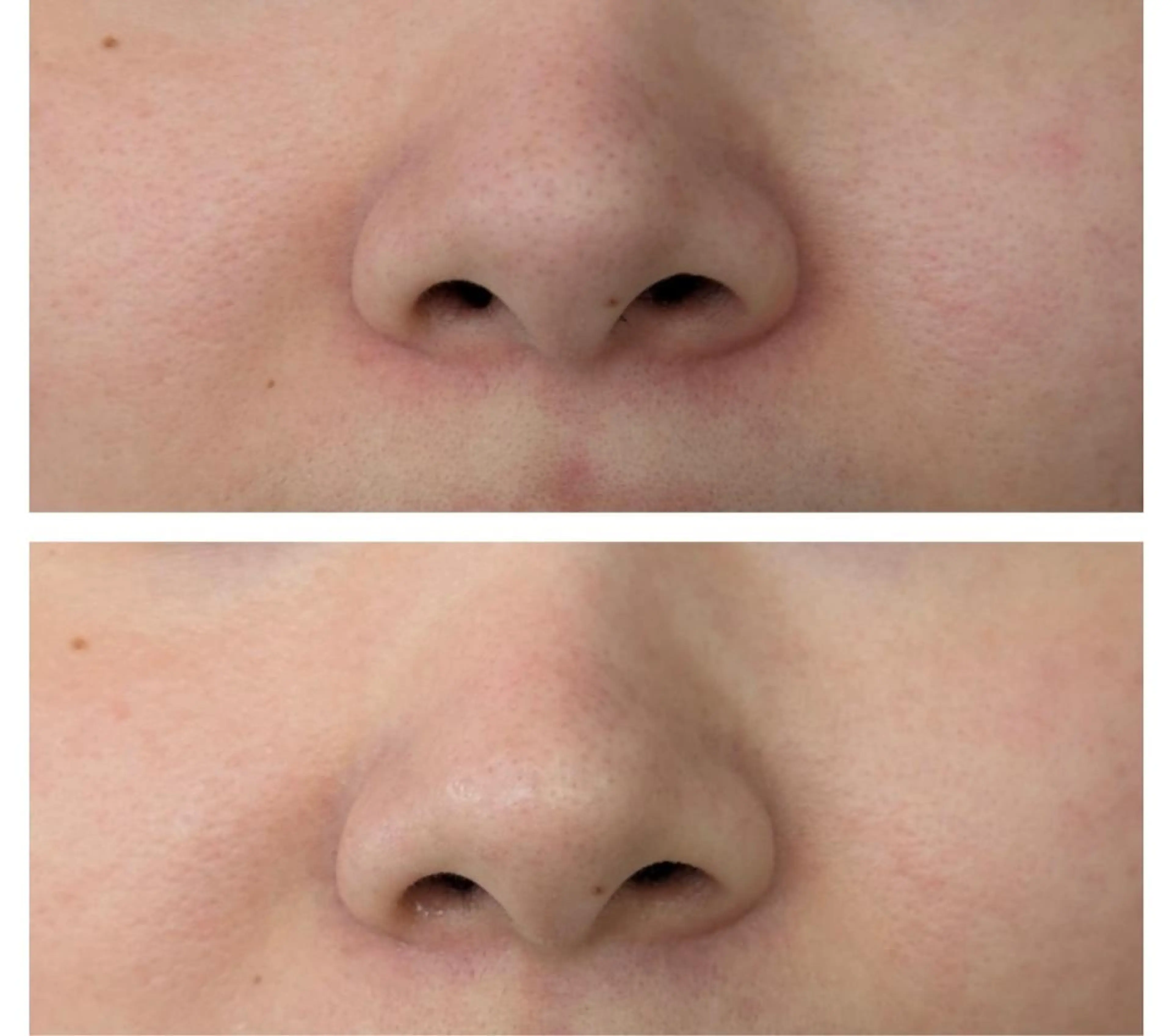 はせがわ せりなのマツエク・マツパデザイン