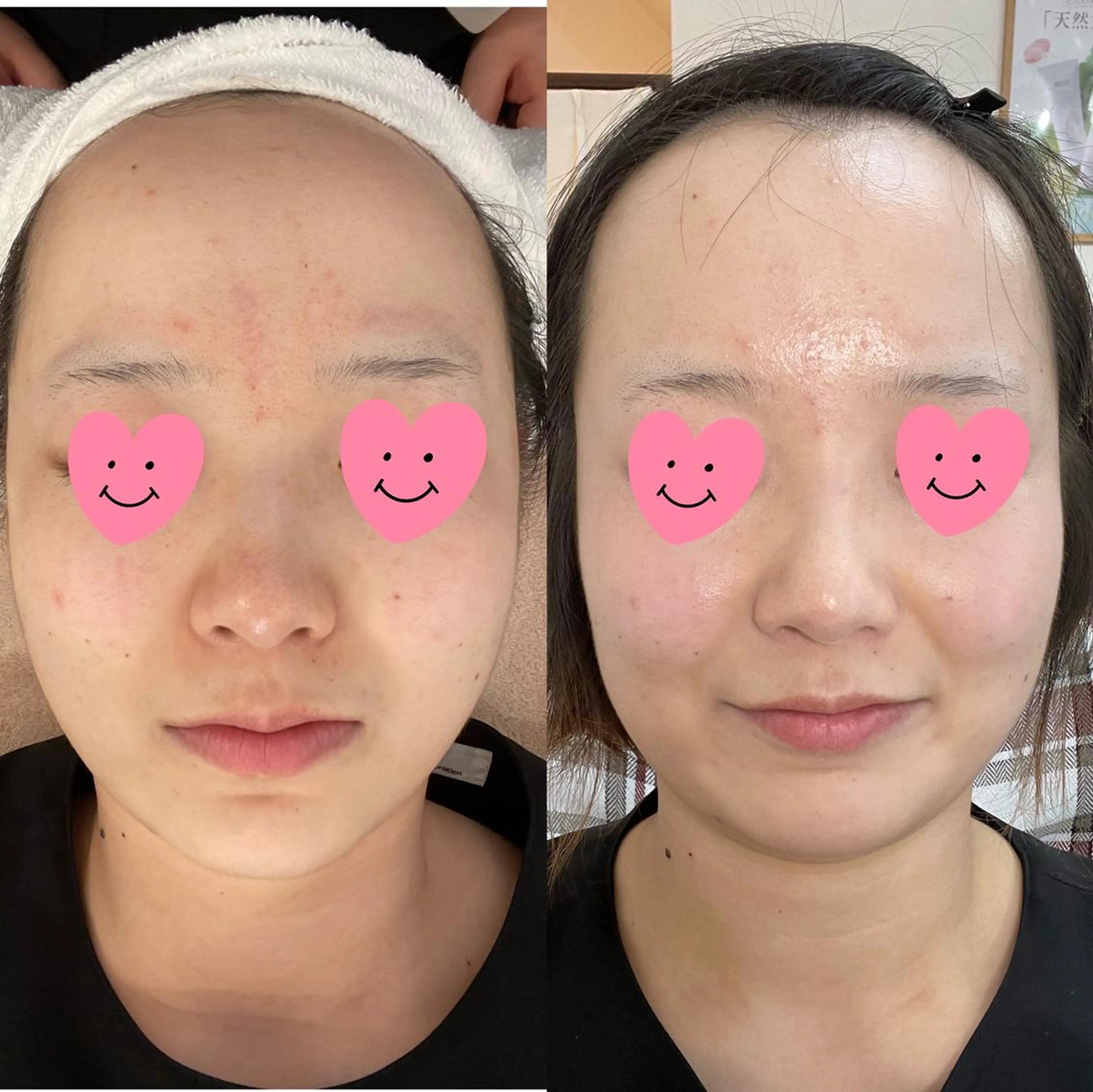 OPREA 千種店のエステ・リラクイメージ