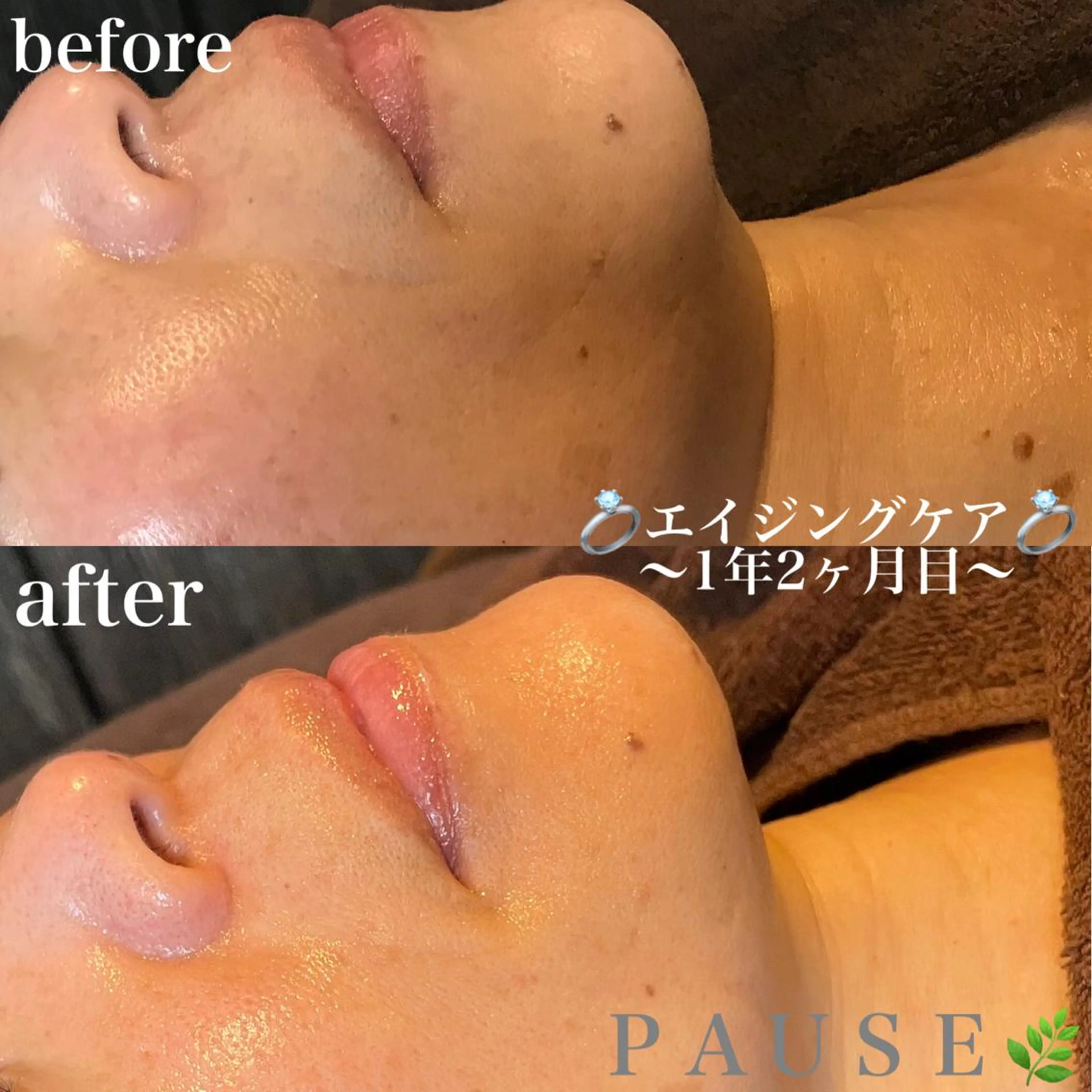 エステ 浜野 恵美のエステ・リラクイメージ