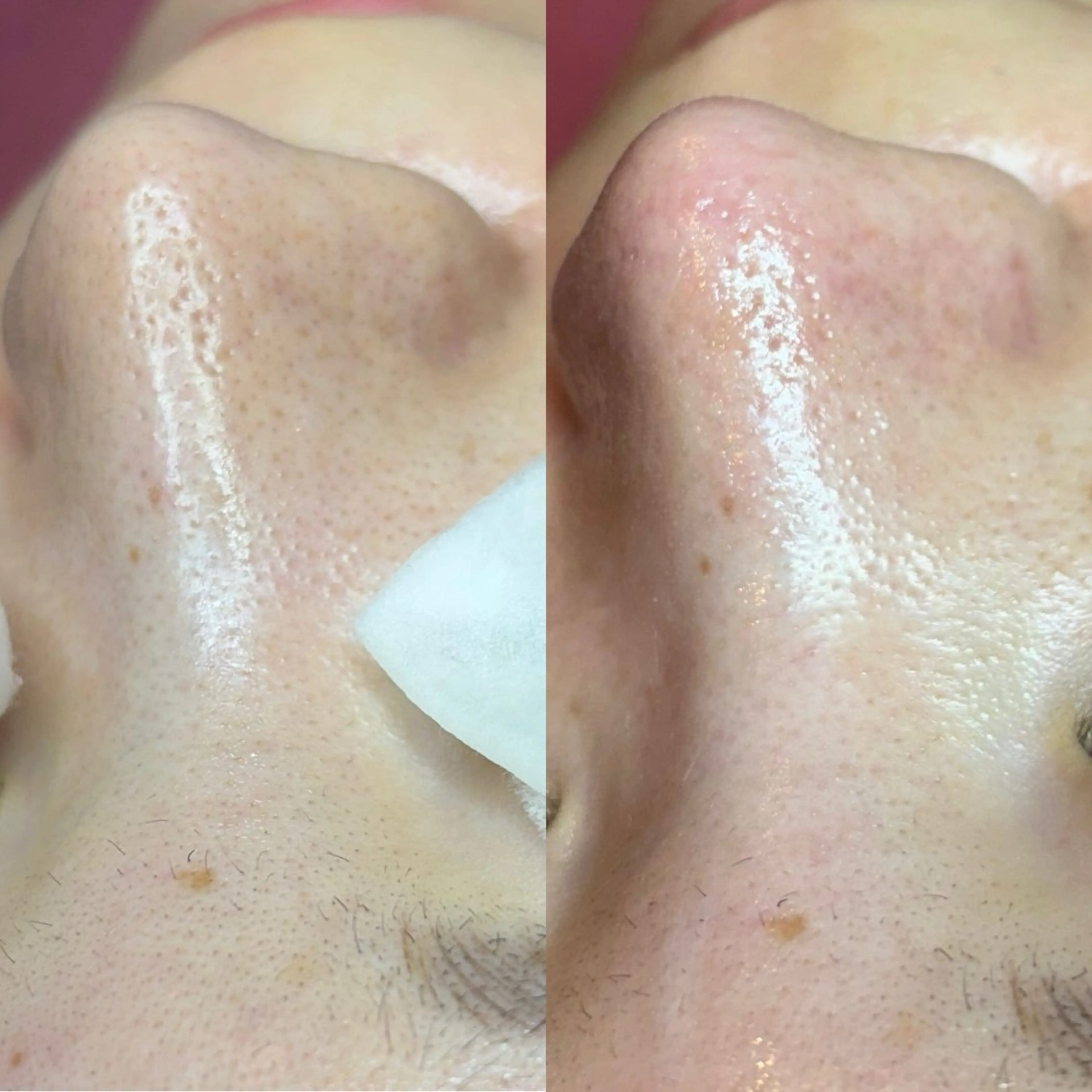 エステ Salon de A所属・【美肌専門店】 Salon de Aのエステ・リラクイメージ