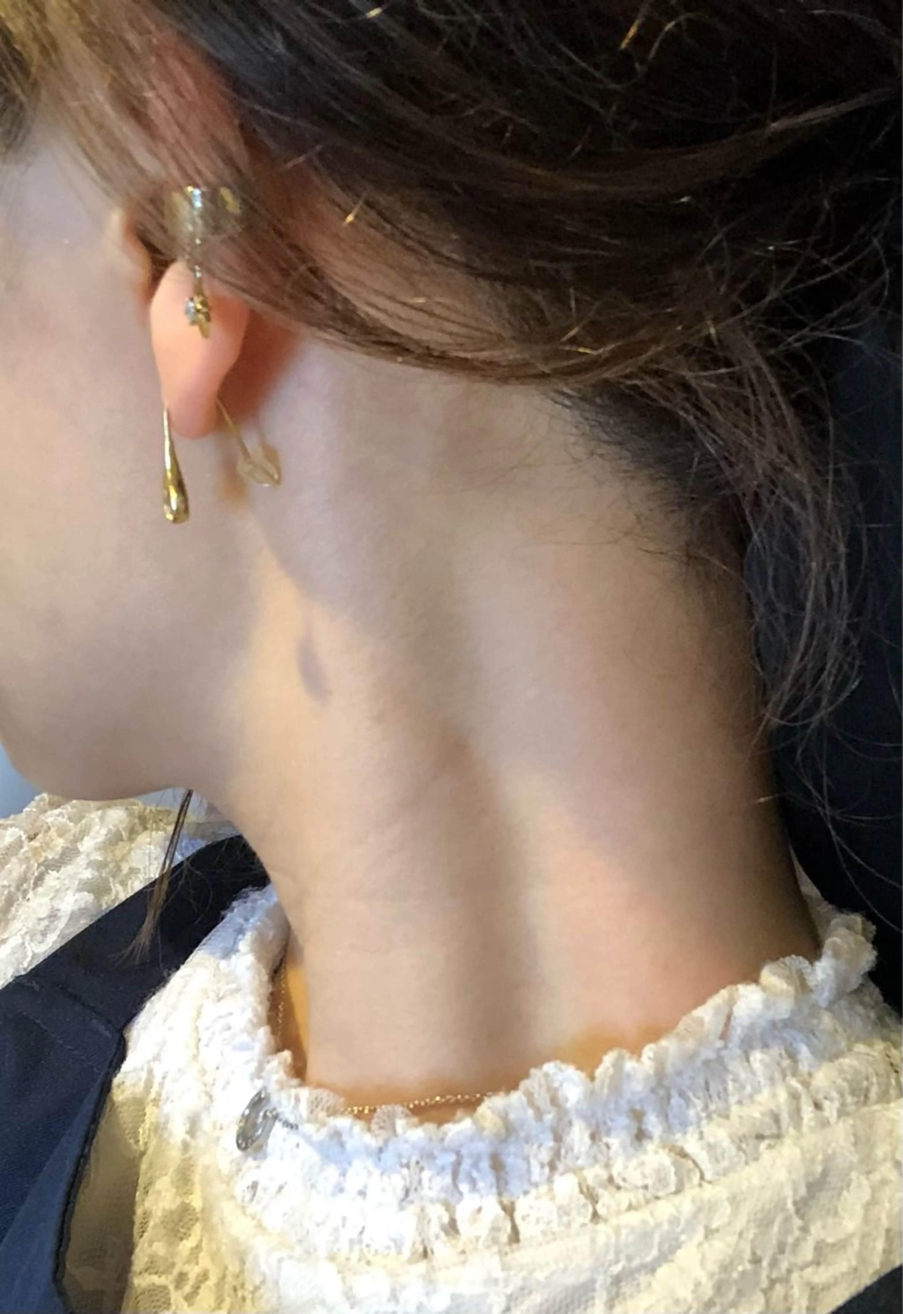 THR光脱毛！えりあしorワキor鼻下 1回¥2,200(レディース限定)の写真