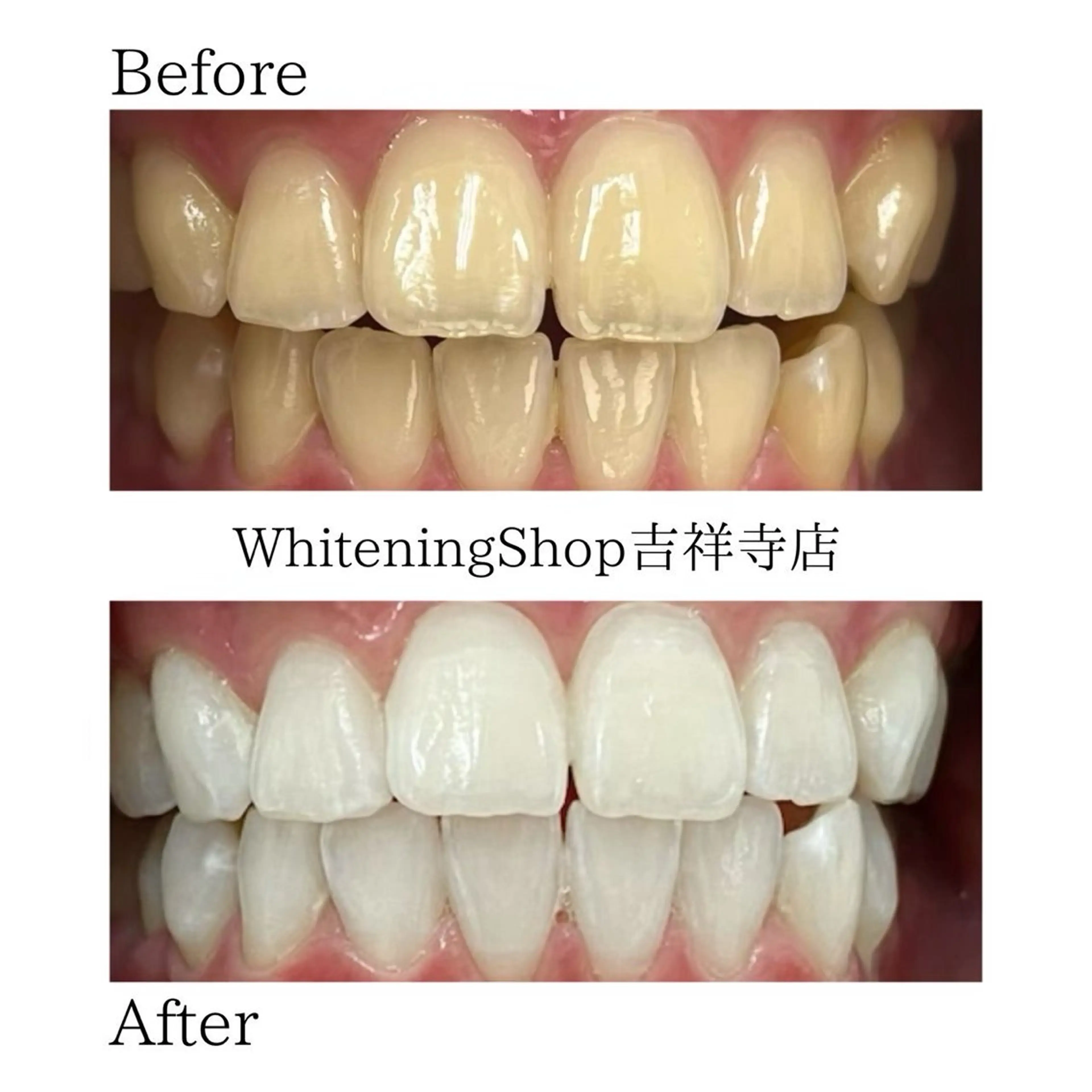 ホワイトニングショッ 吉祥寺2号店のエステ・リラクイメージ