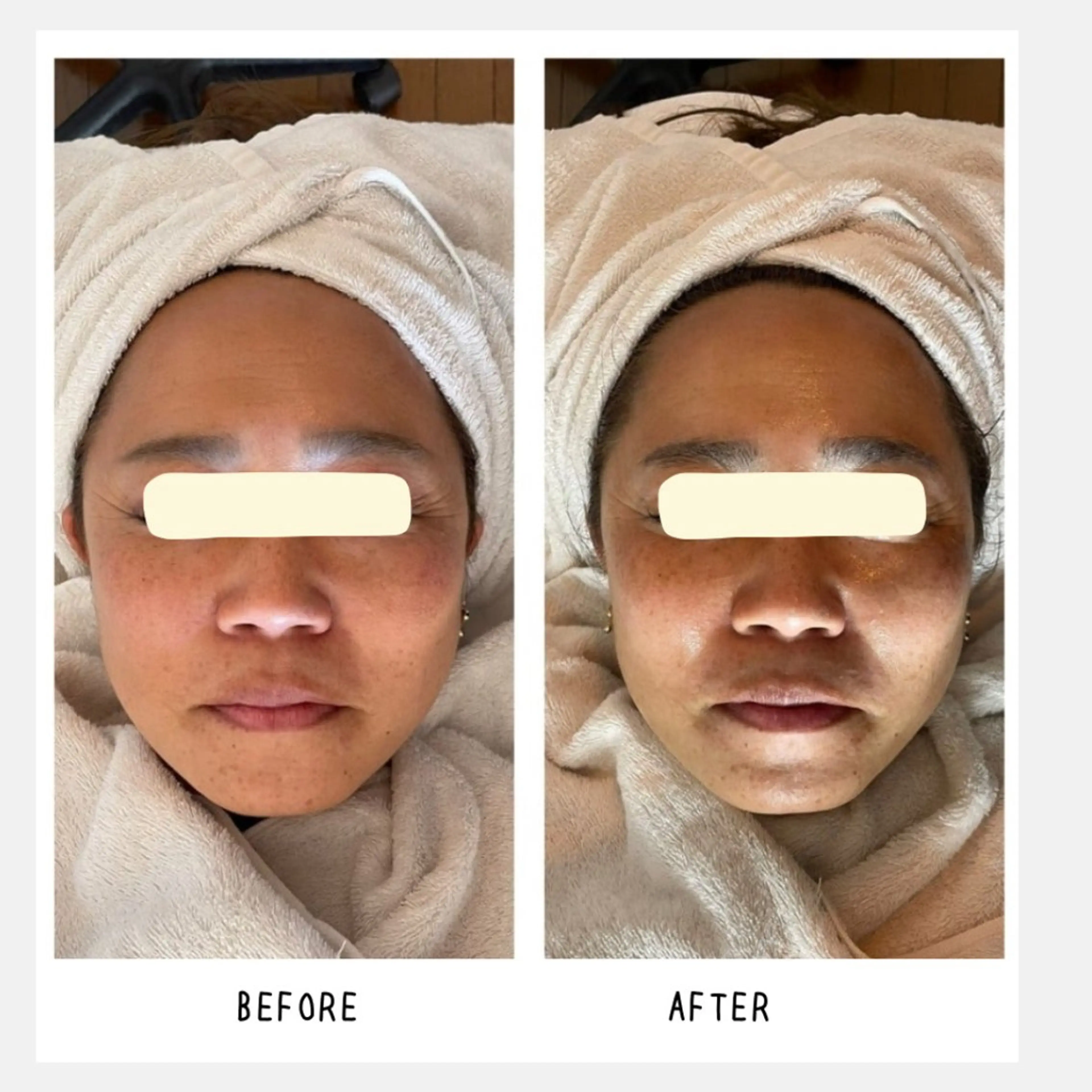 grow所属・Yoshino Erinaのエステ・リラクイメージ