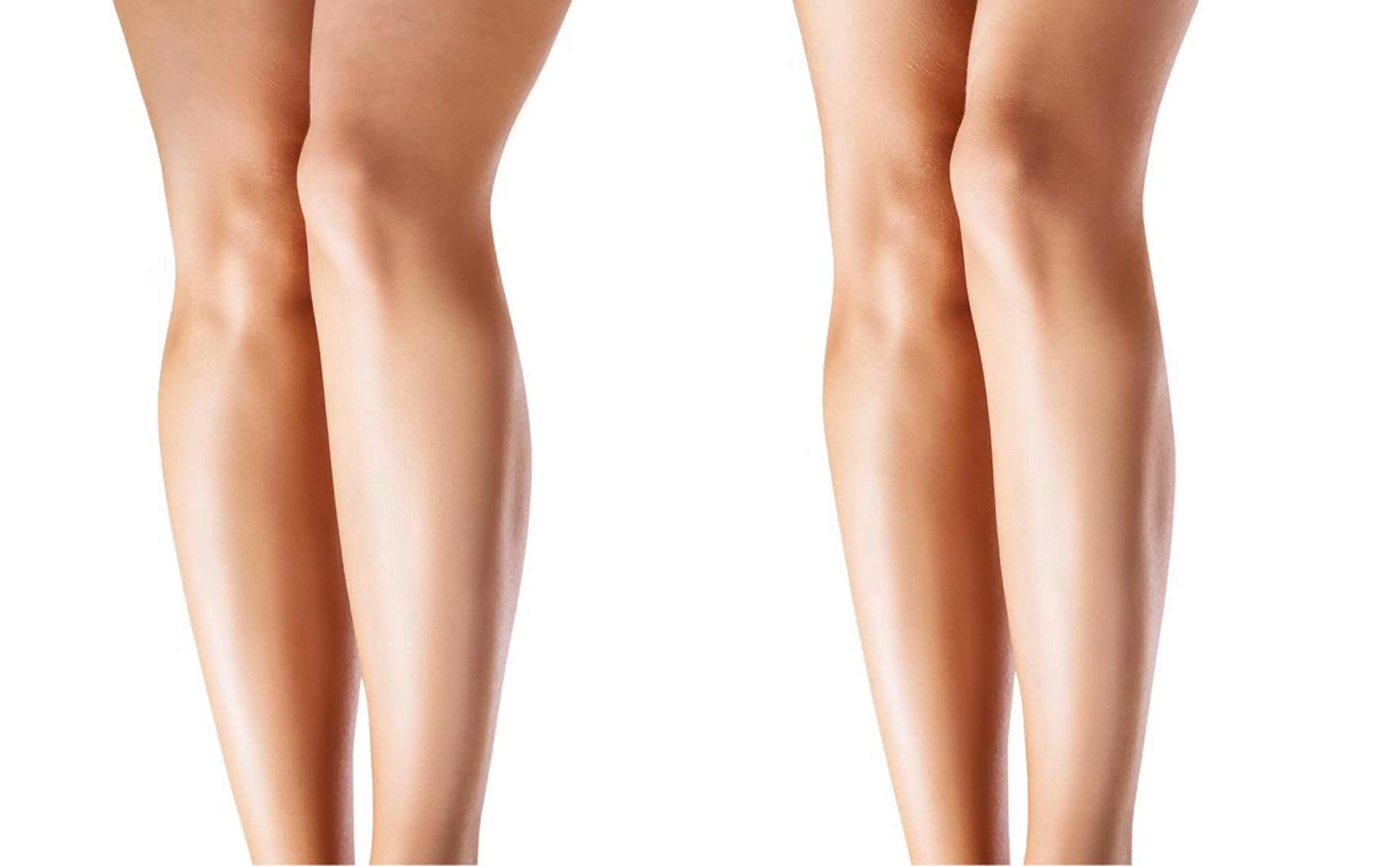 エステ 美脚マエストラ 上野由理のその他イメージ