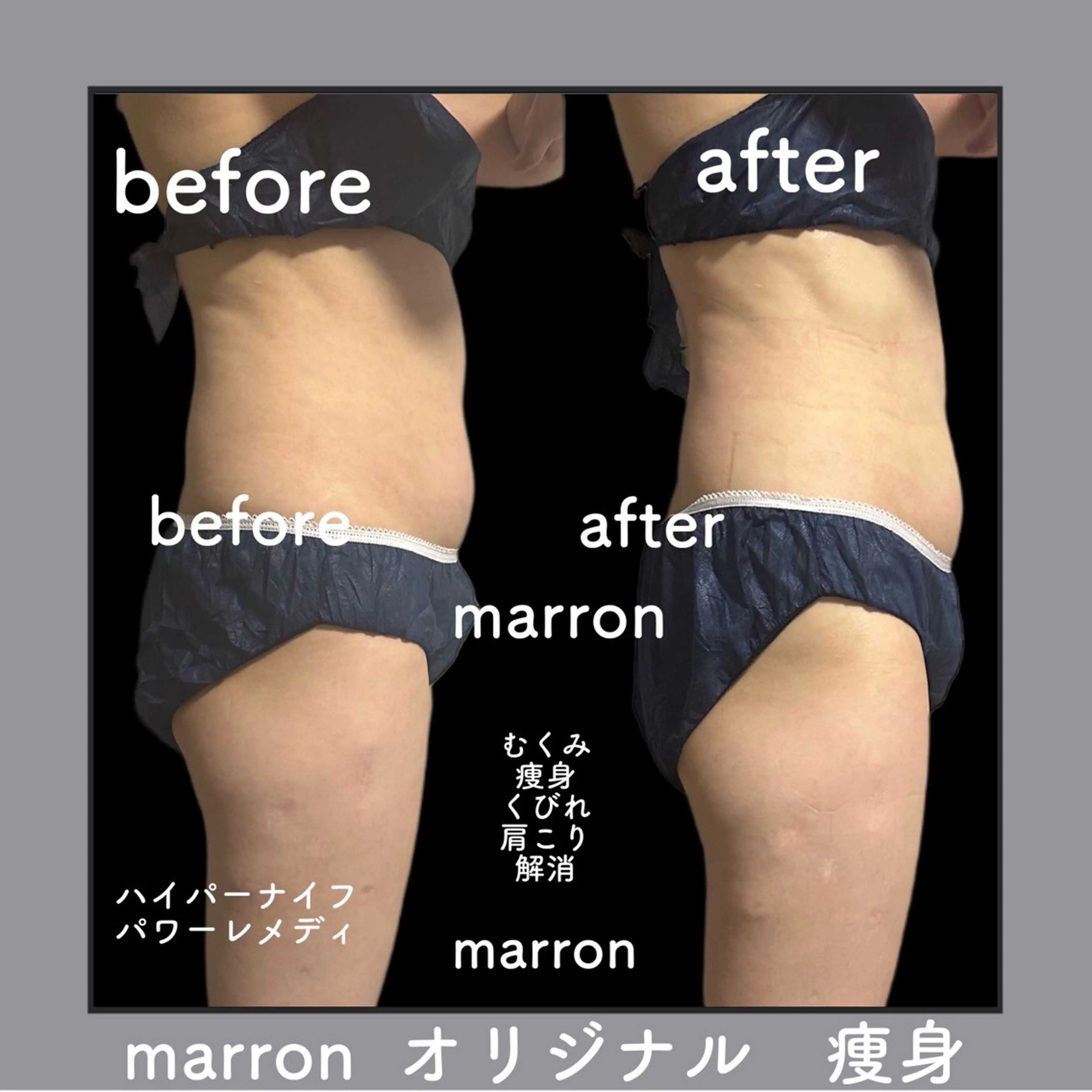 marron所属・痩身ハイパーナイフ ララピールリアボーテのエステ・リラクイメージ