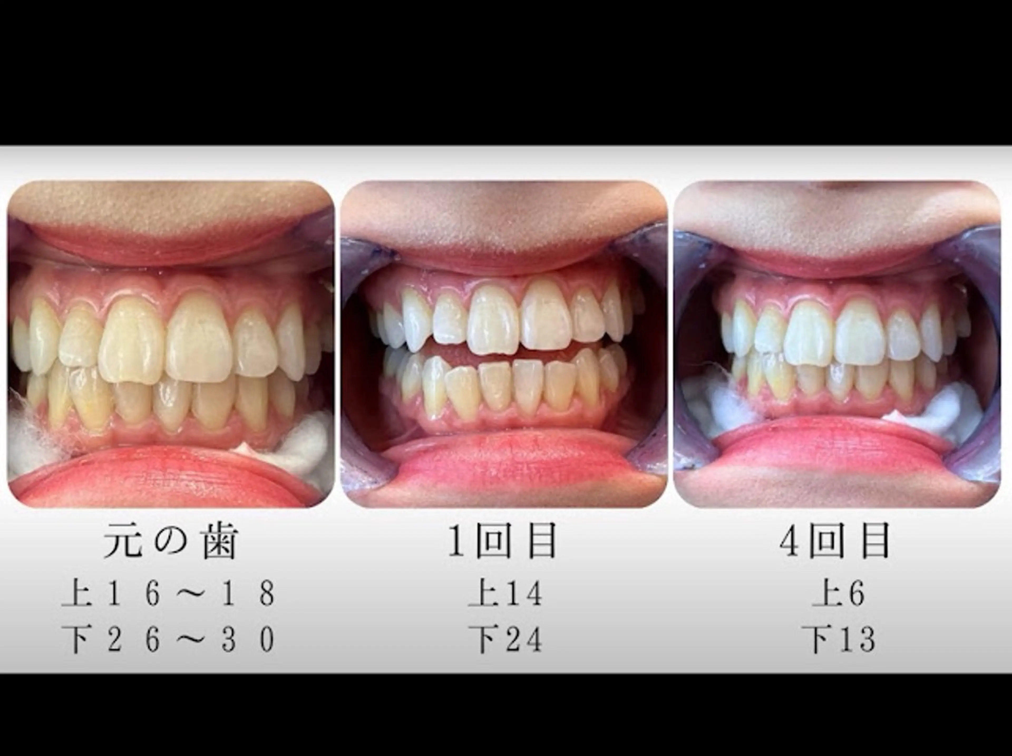 エステ リラク エクシア町田店所属・miku .のエステ・リラクイメージ