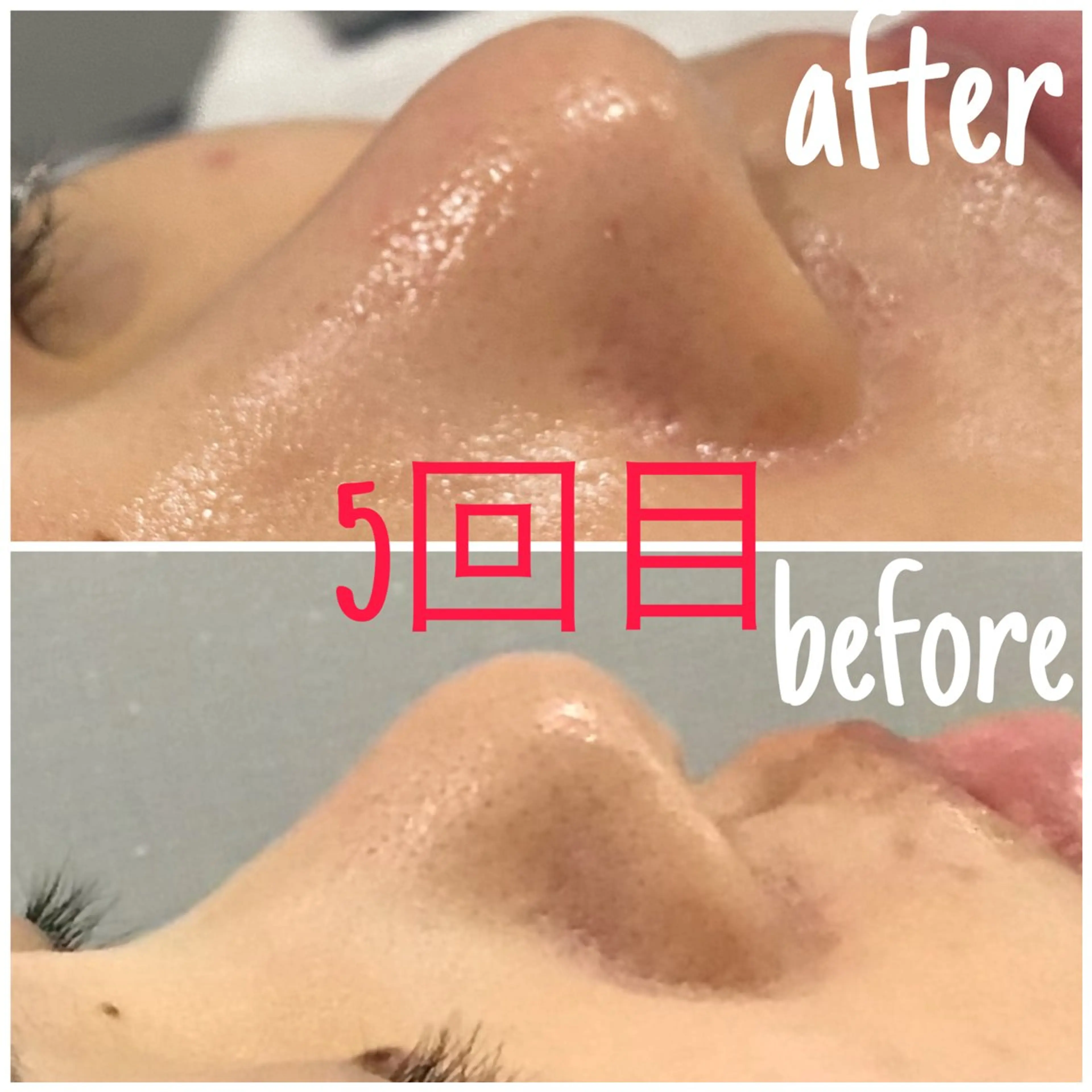 エステ 毛穴洗浄・痩身・脱毛 /アルカンジュのエステ・リラクイメージ