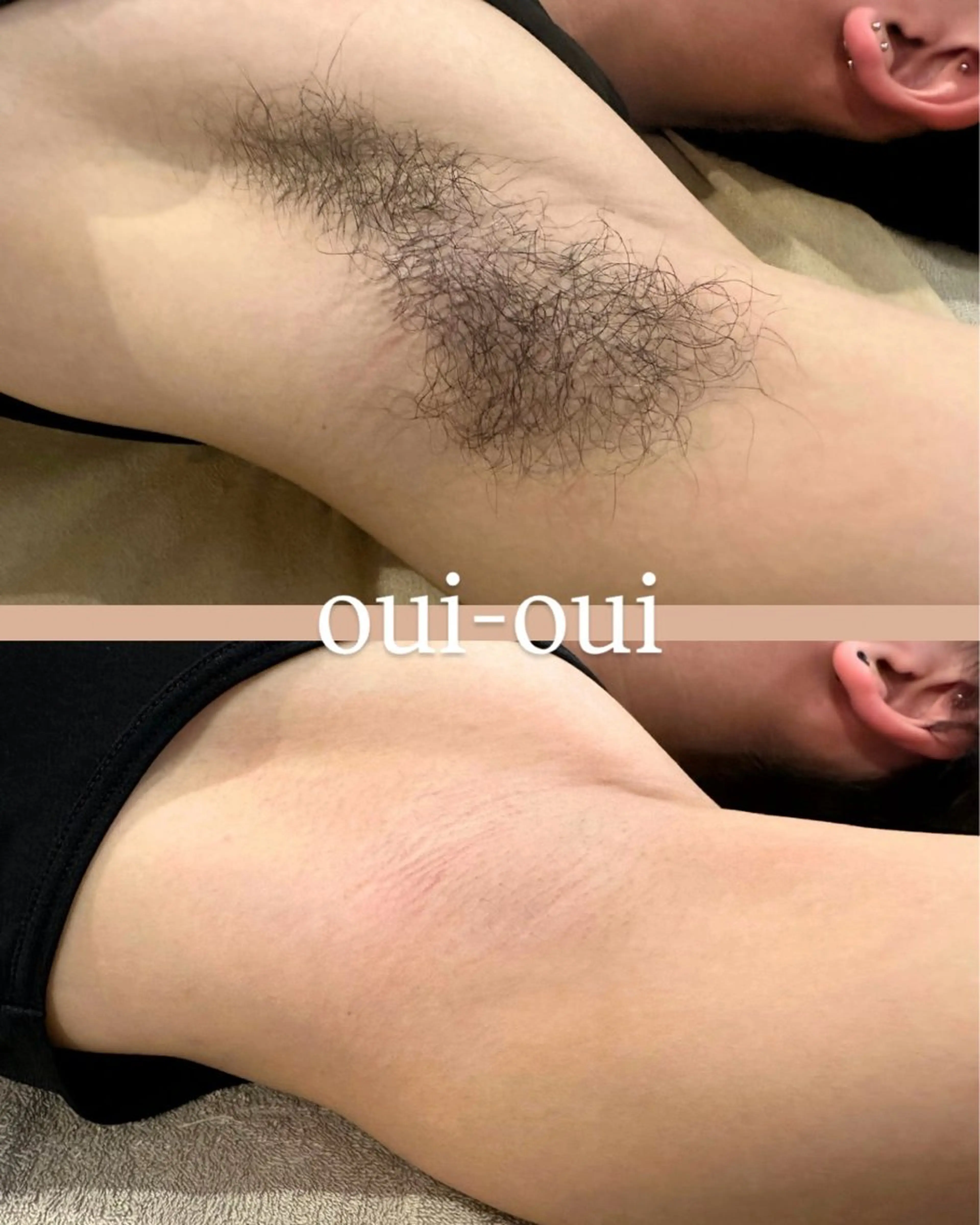 oui-oui　ウィウィ所属・oui-oui 磐田脱毛のエステ・リラクイメージ