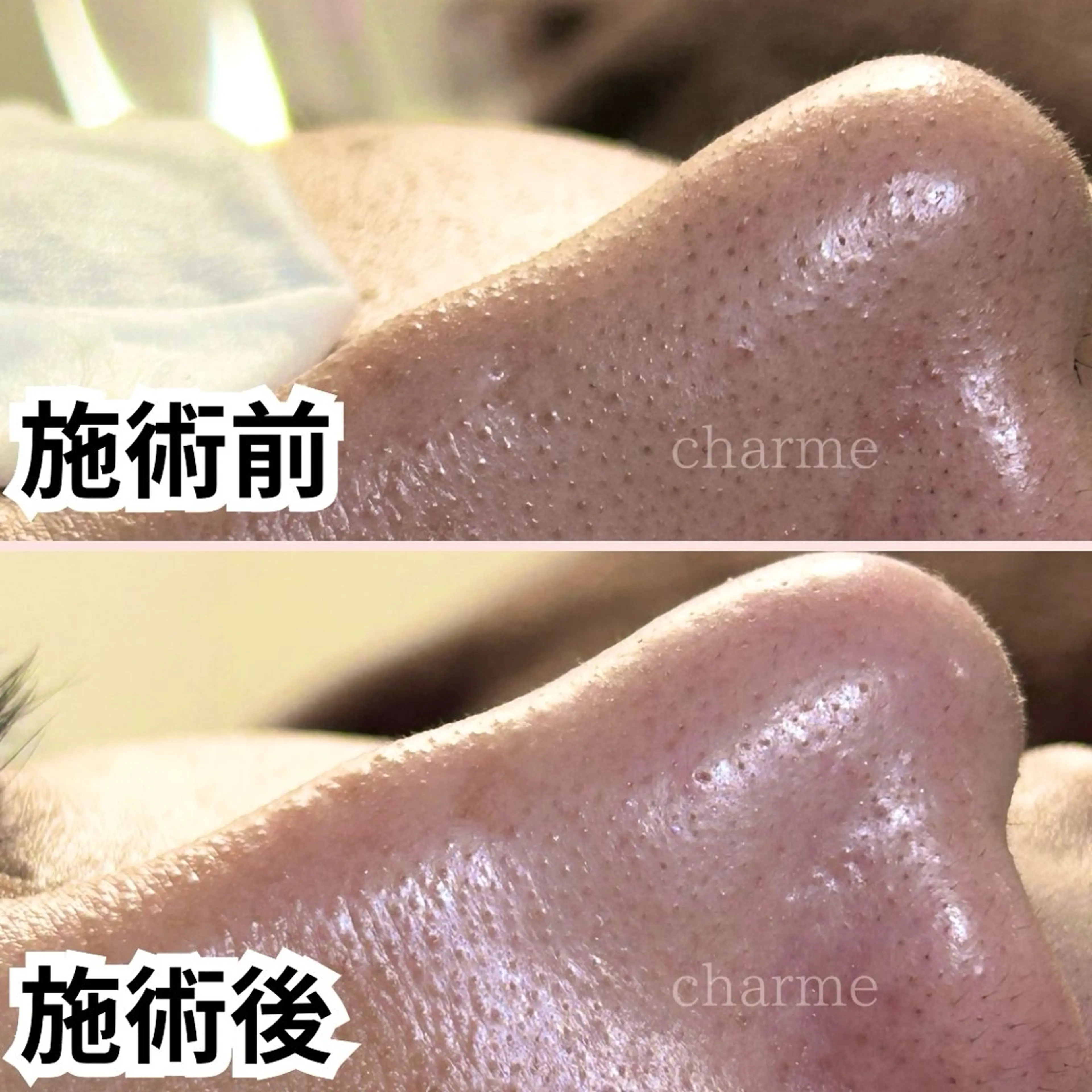 【ぱっちり長持ち✨】次世代まつげパーマ🌿ナチュラル美人仕上げ💐の写真