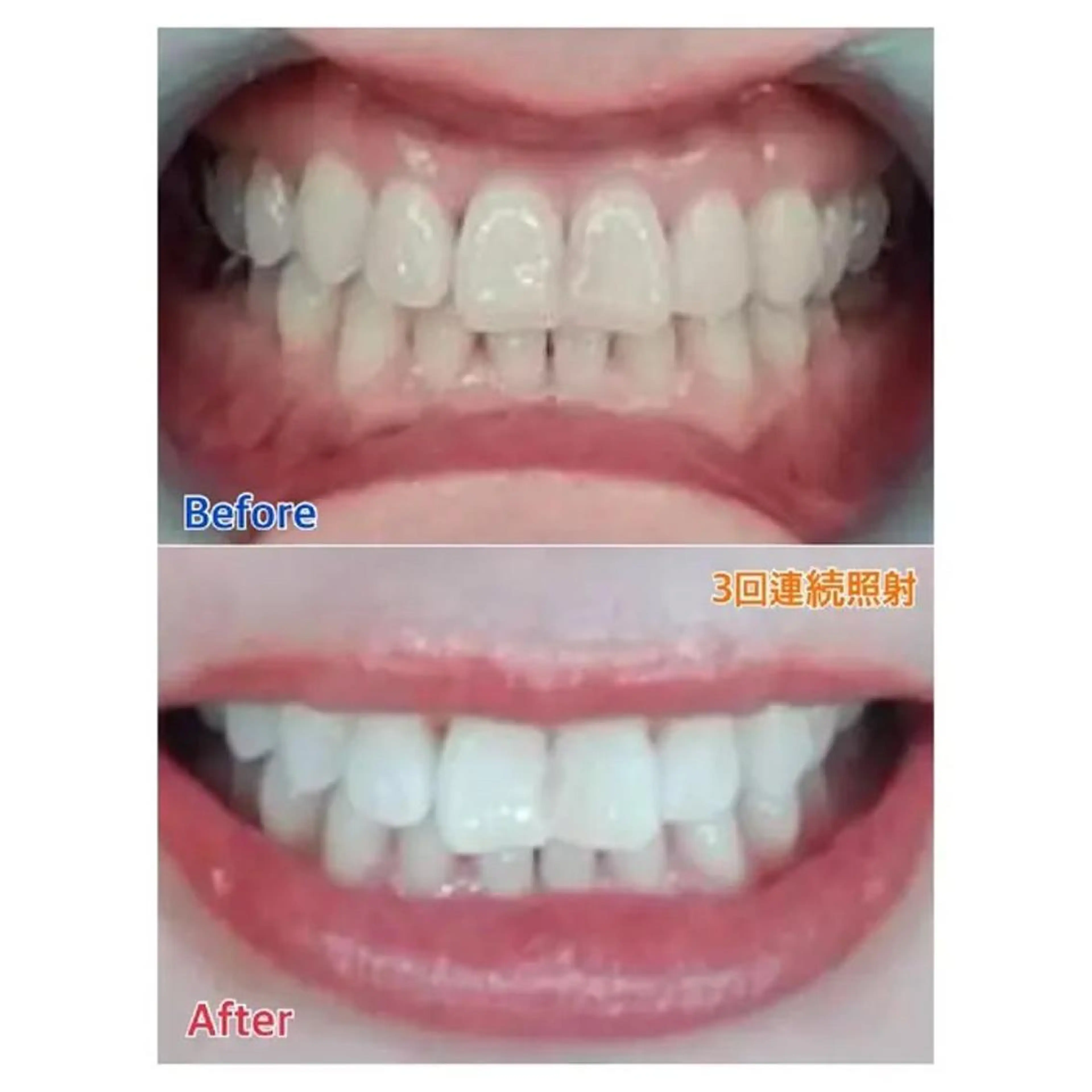 M渋谷店所属・M渋谷 ホワイトニングのエステ・リラクイメージ