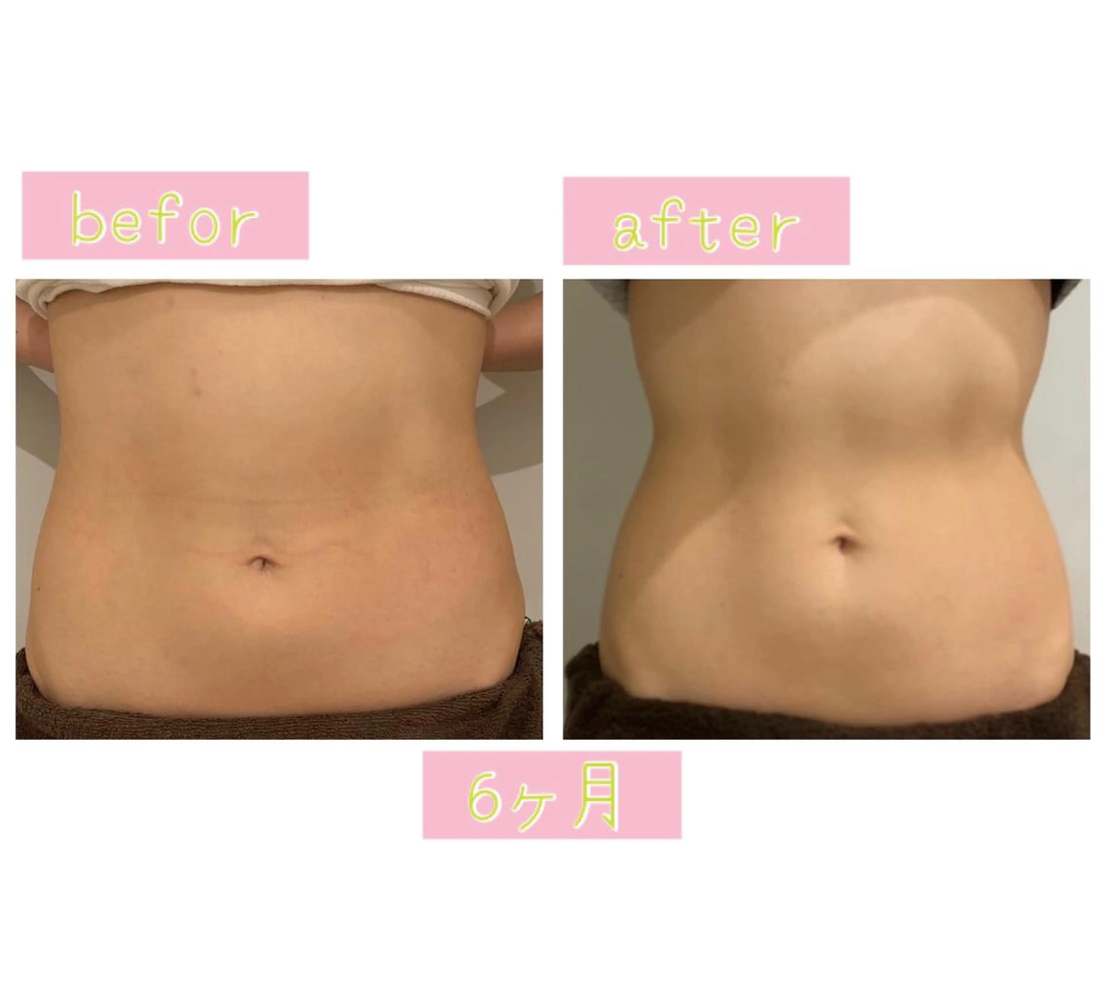 エステ 癒し腸もみサロン シャユーム　ゆきなのエステ・リラクイメージ