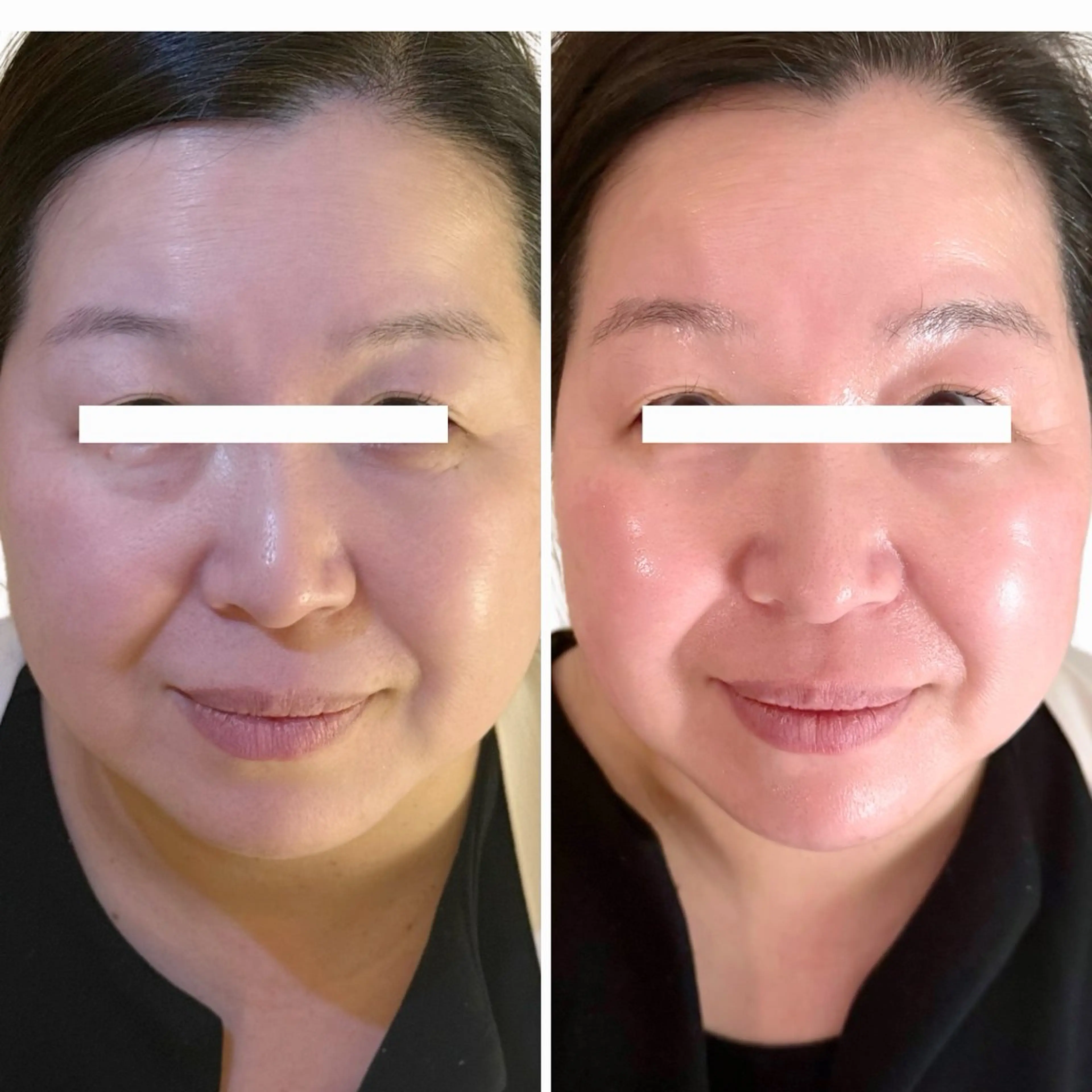 その他 Astorie 相模大野エステのその他イメージ