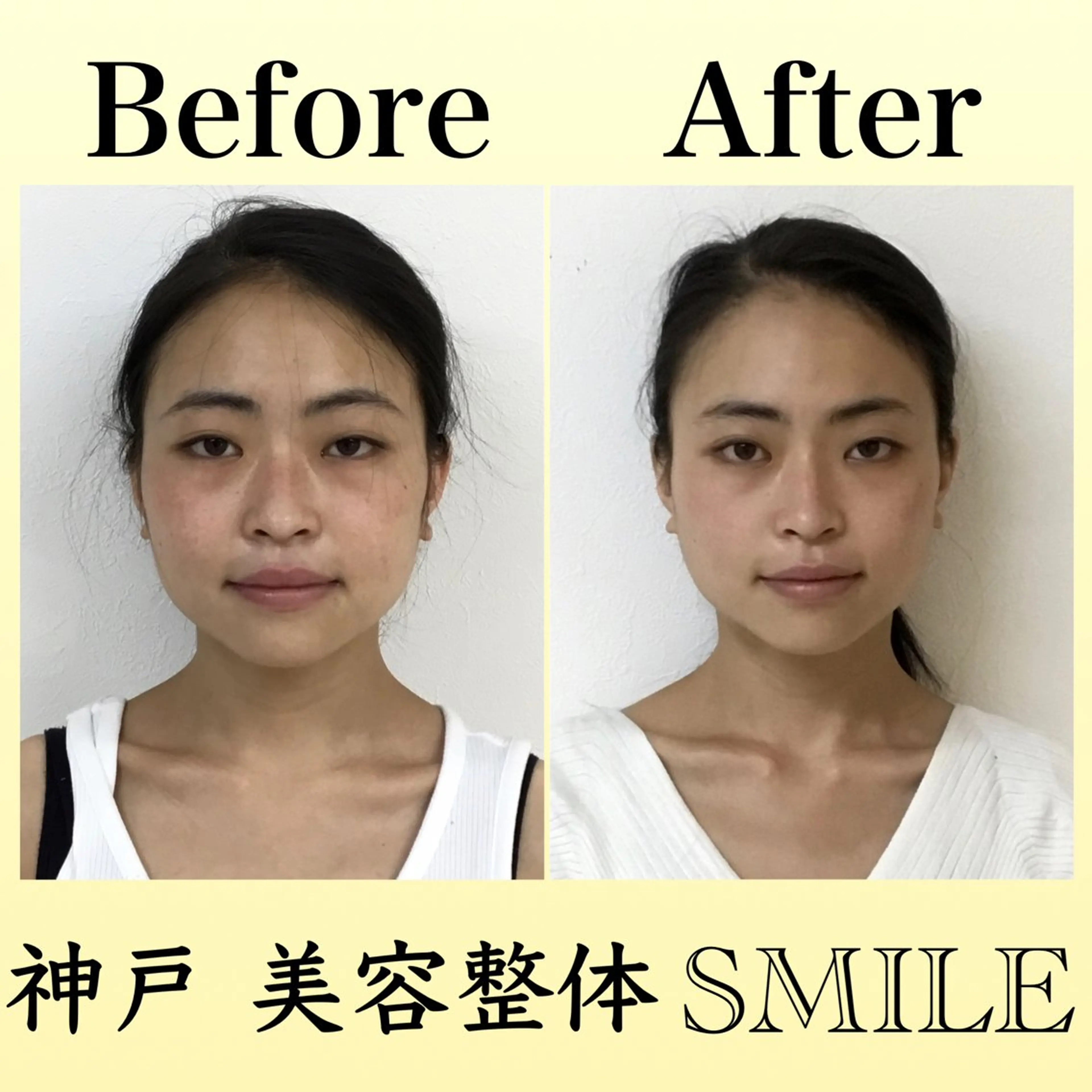 エステ リラク 【小顔・姿勢矯正】 美容整体 SMILEのエステ・リラクイメージ