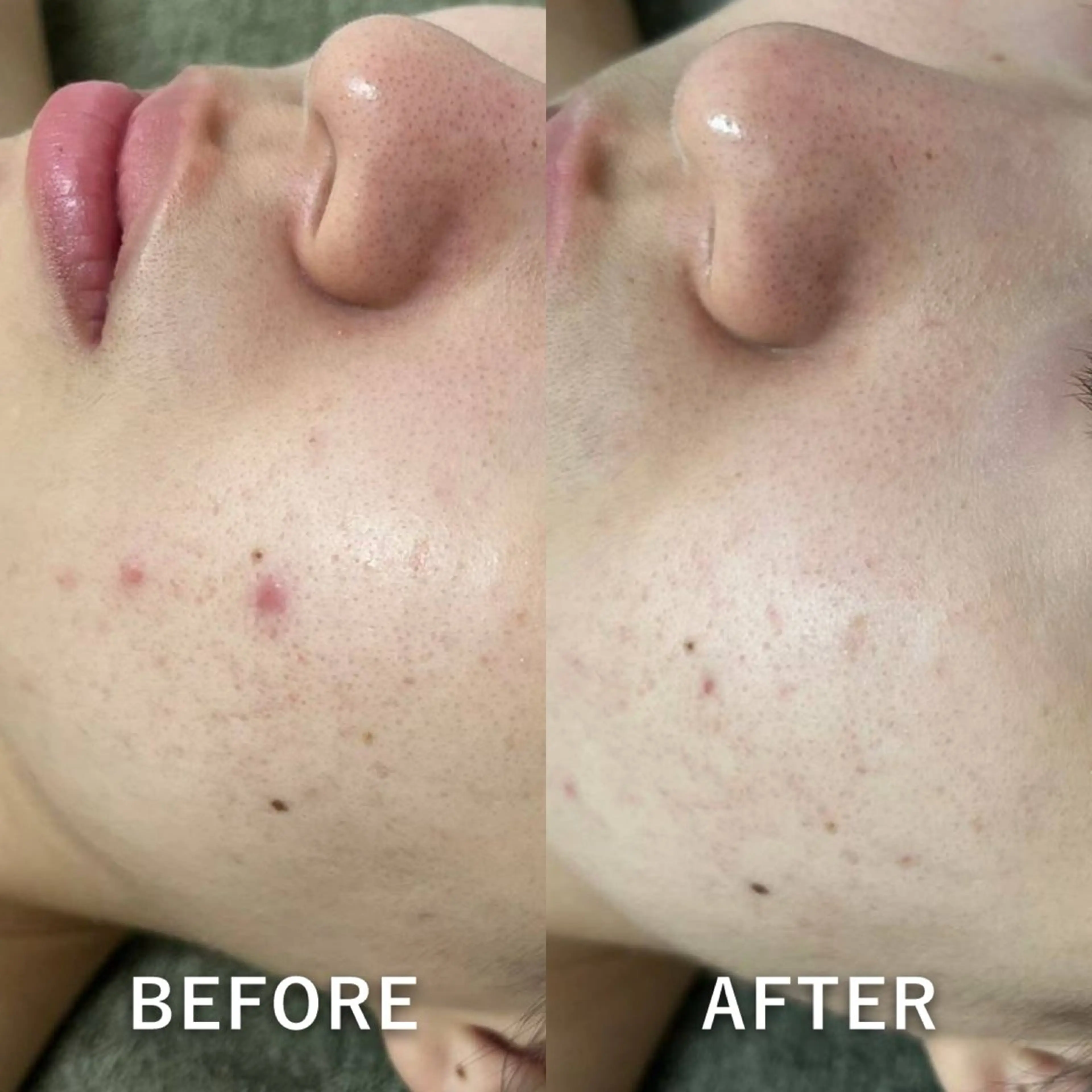 韓国美肌/肌質改善 【天神】yuiのエステ・リラクイメージ