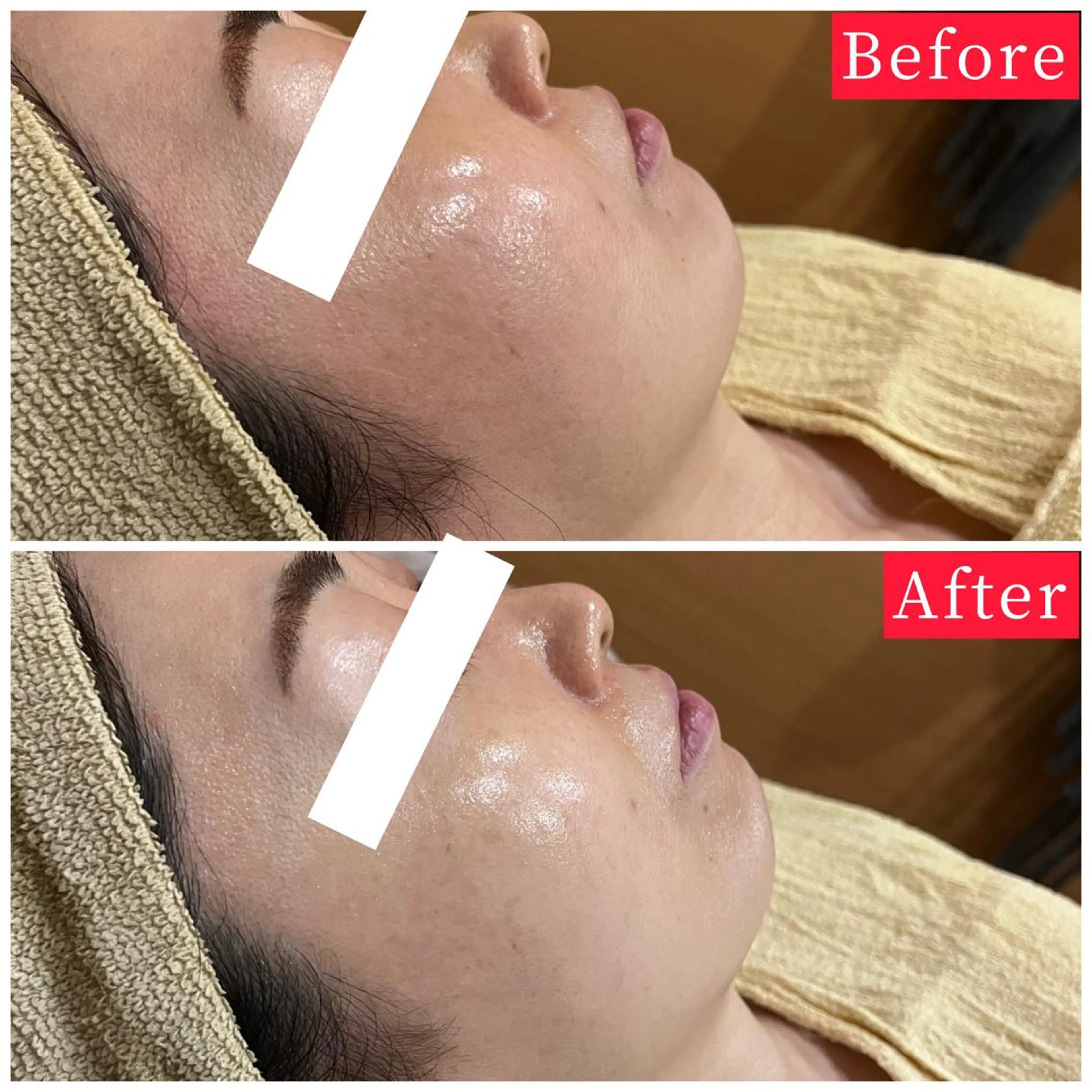 ハーブピーリング専門 muro.のエステ・リラクイメージ