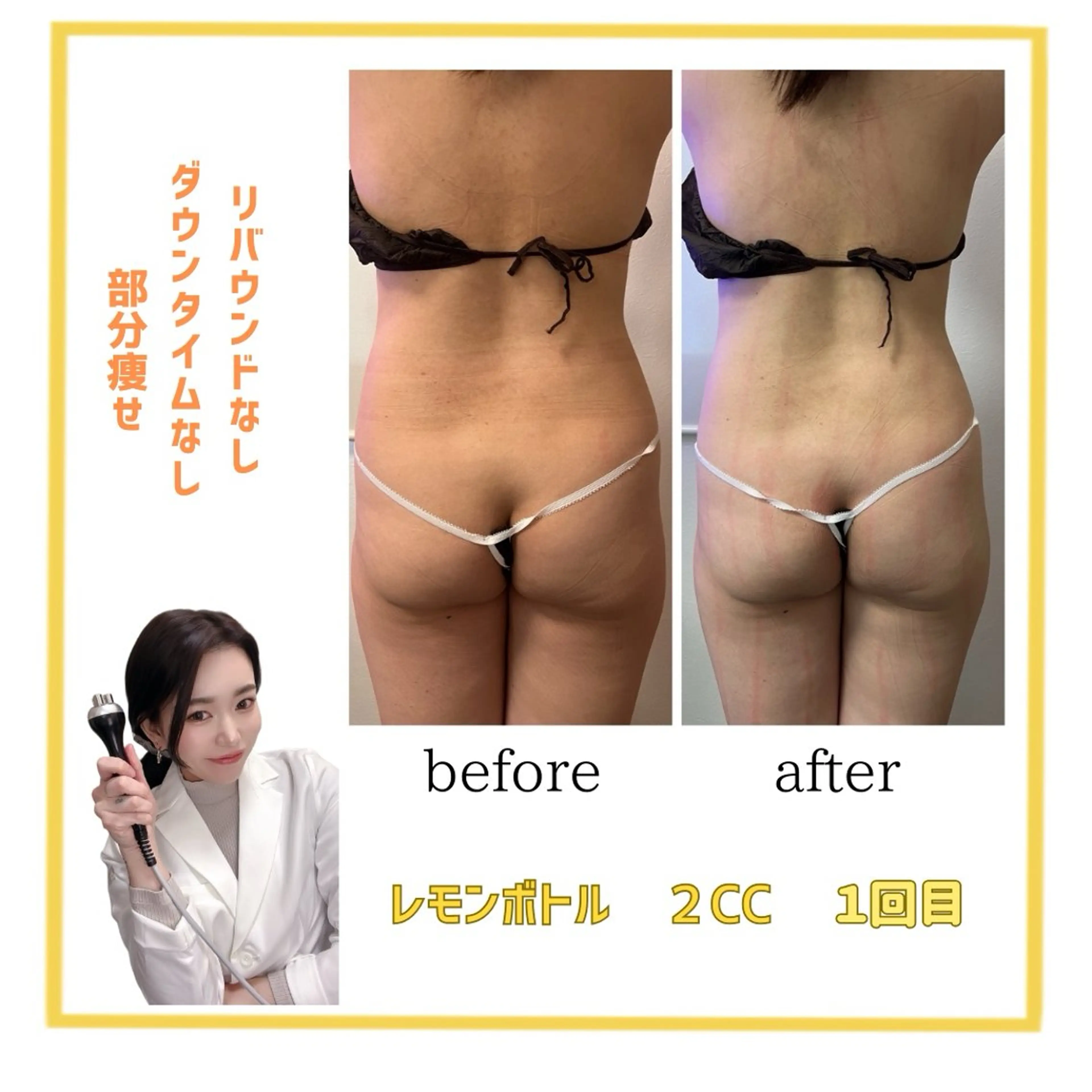 本気で痩せたい方へ 痩身専門サロンのエステ・リラクイメージ