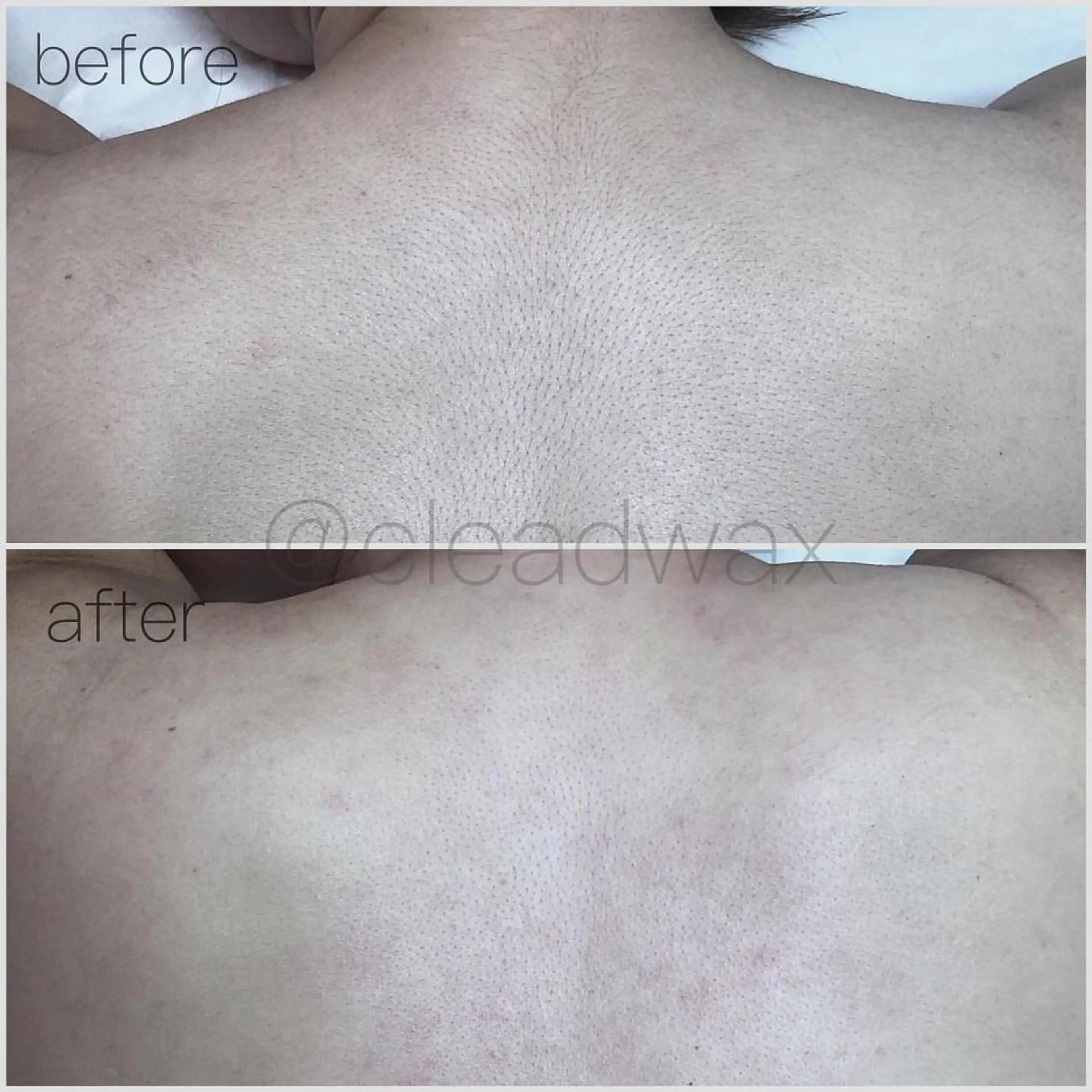 CLEAD赤坂見附店 坂田のエステ・リラクイメージ