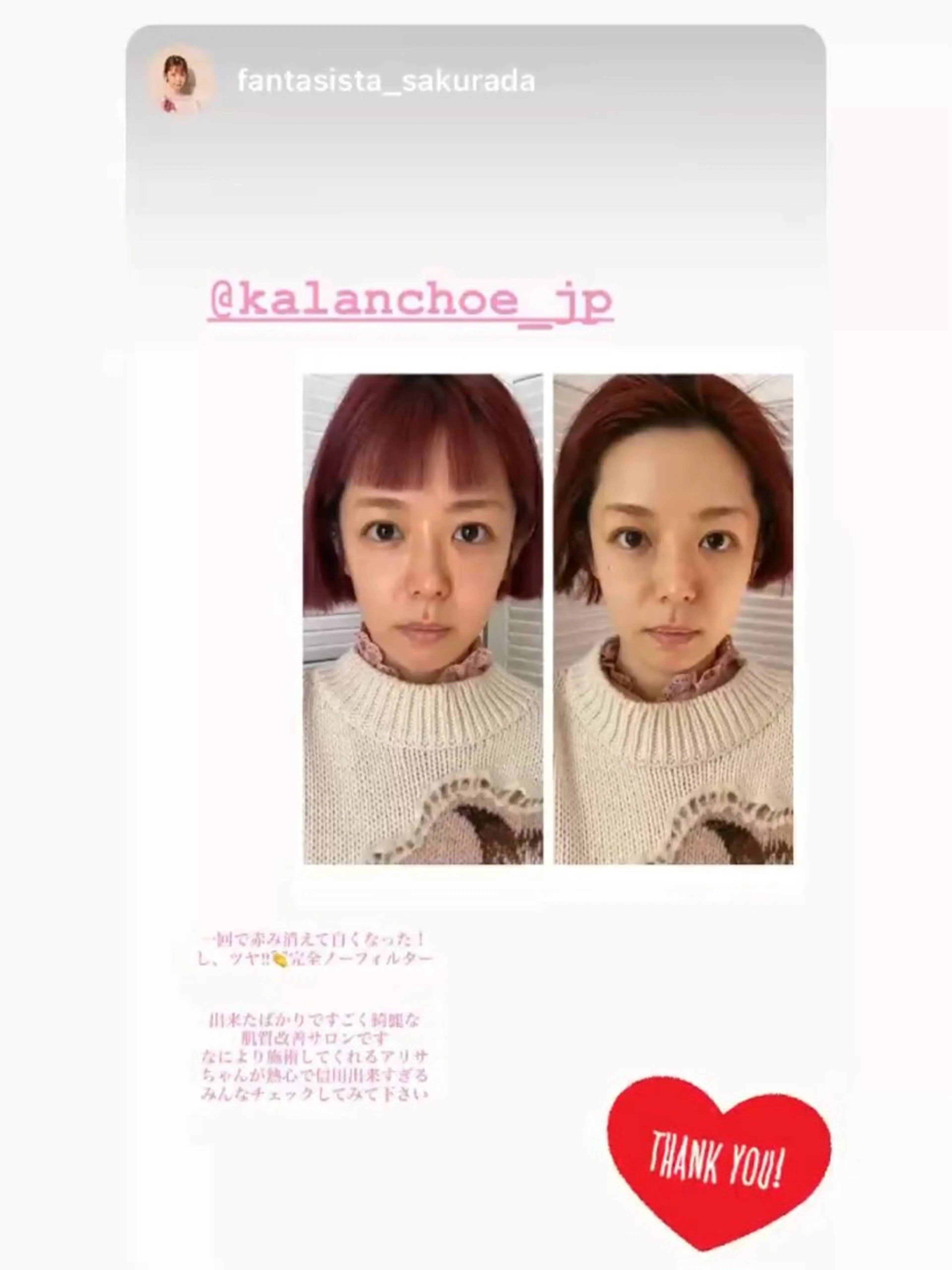 エステ 肌質改善 KALANCHOEのエステ・リラクイメージ