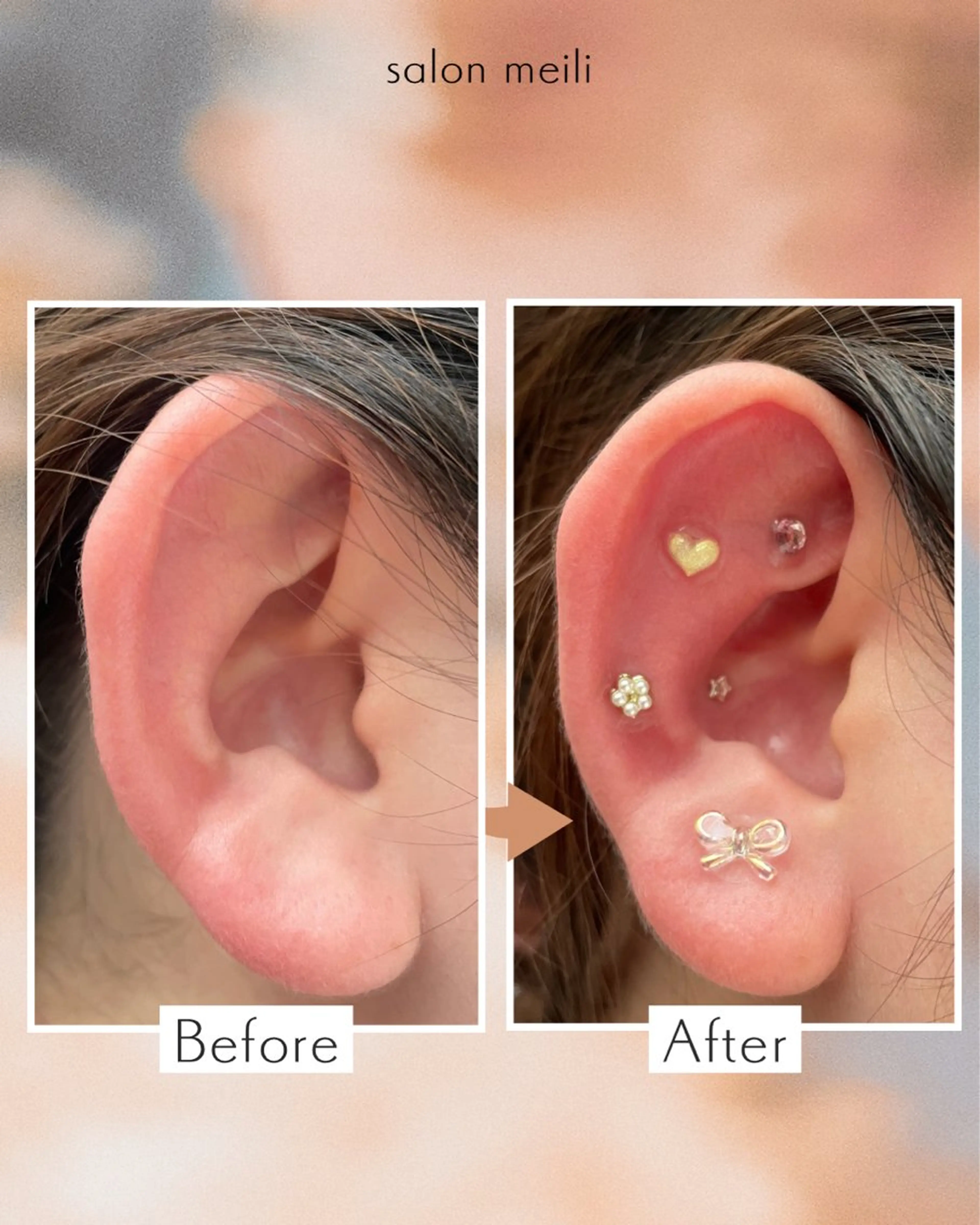 耳つぼジュエリー12粒💎の写真