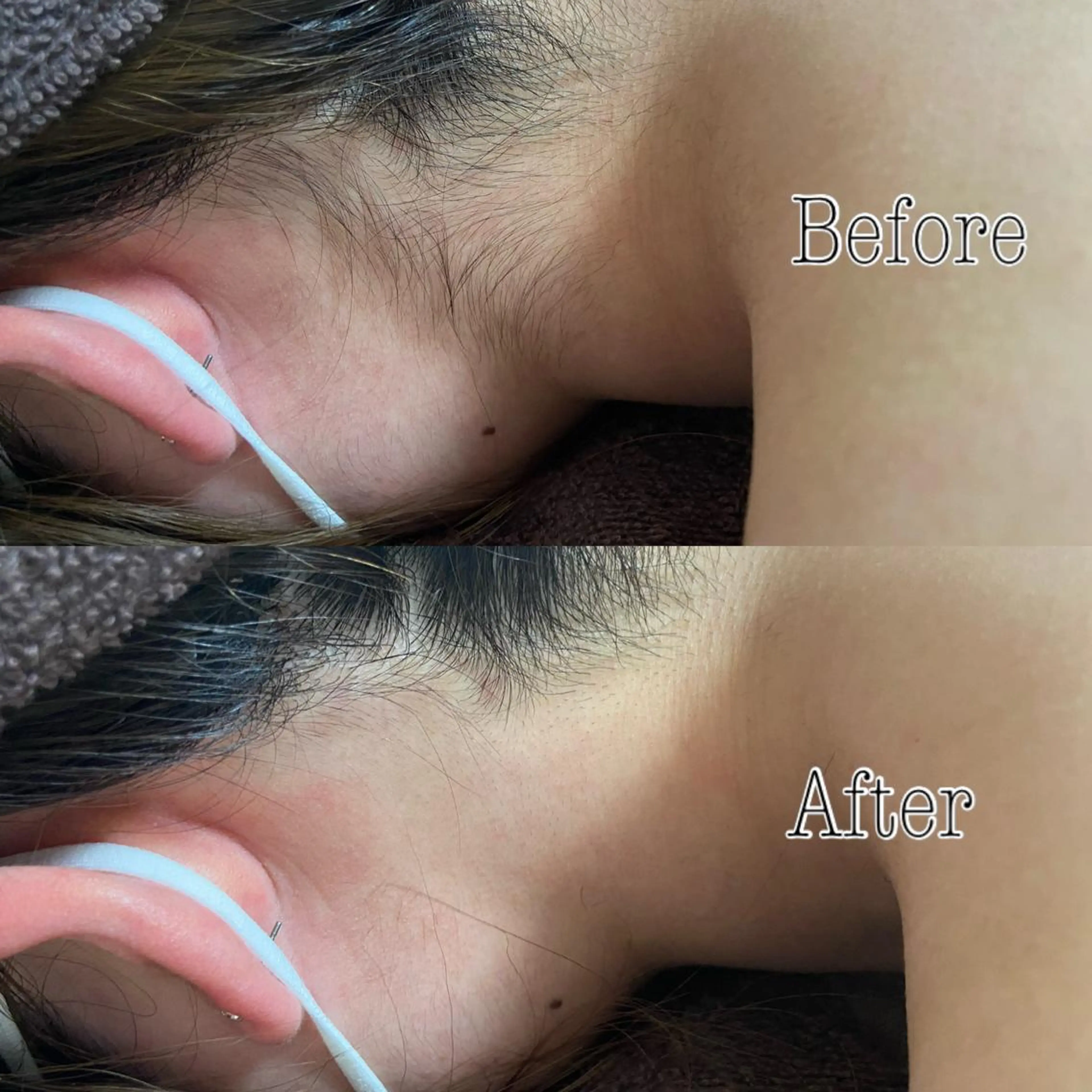 都度払い制脱毛サロンBe Charm所属・Be Charm 山﨑のエステ・リラクイメージ