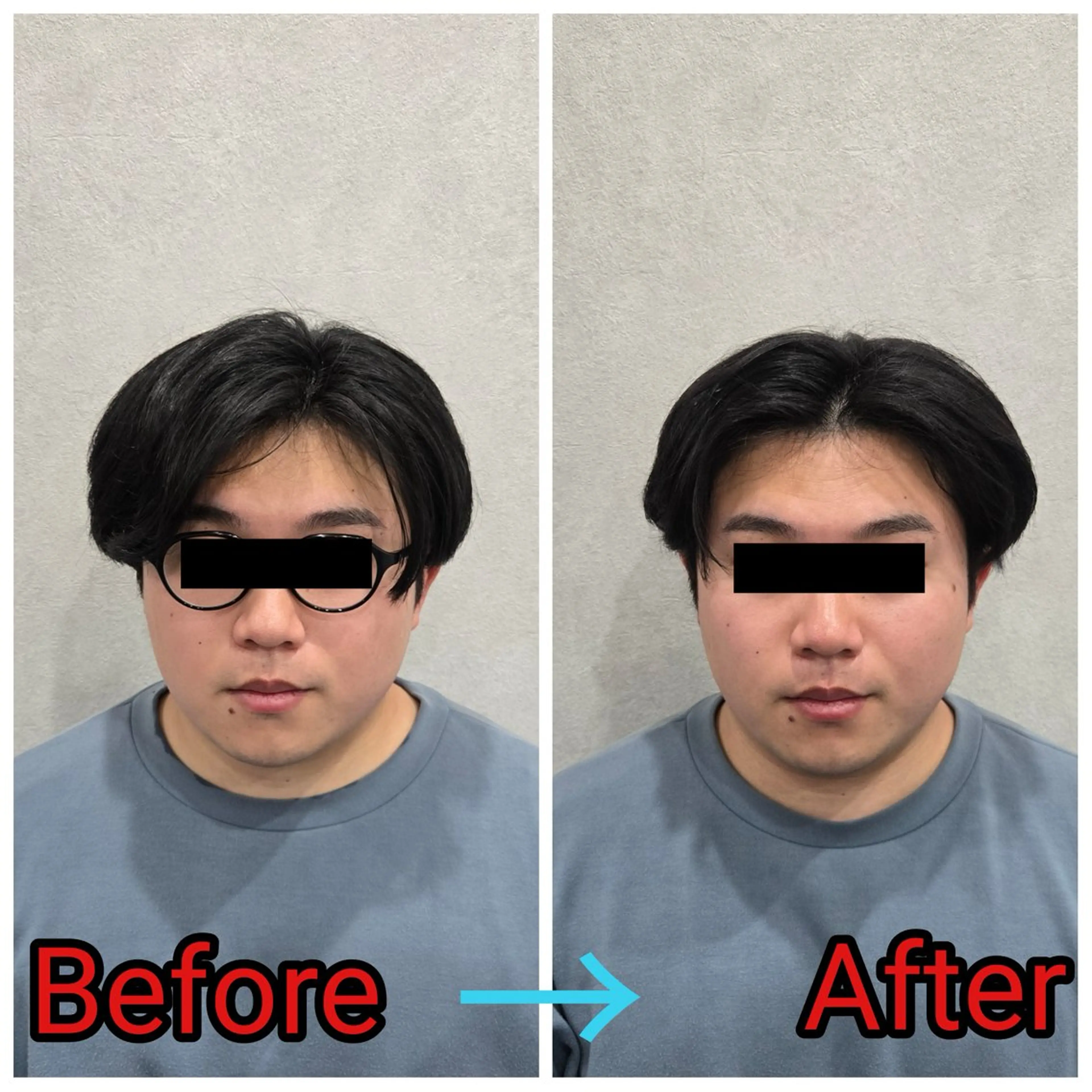 エステ リラク 小顔矯正・美容鍼 FLOW鍼灸整体院のエステ・リラクイメージ