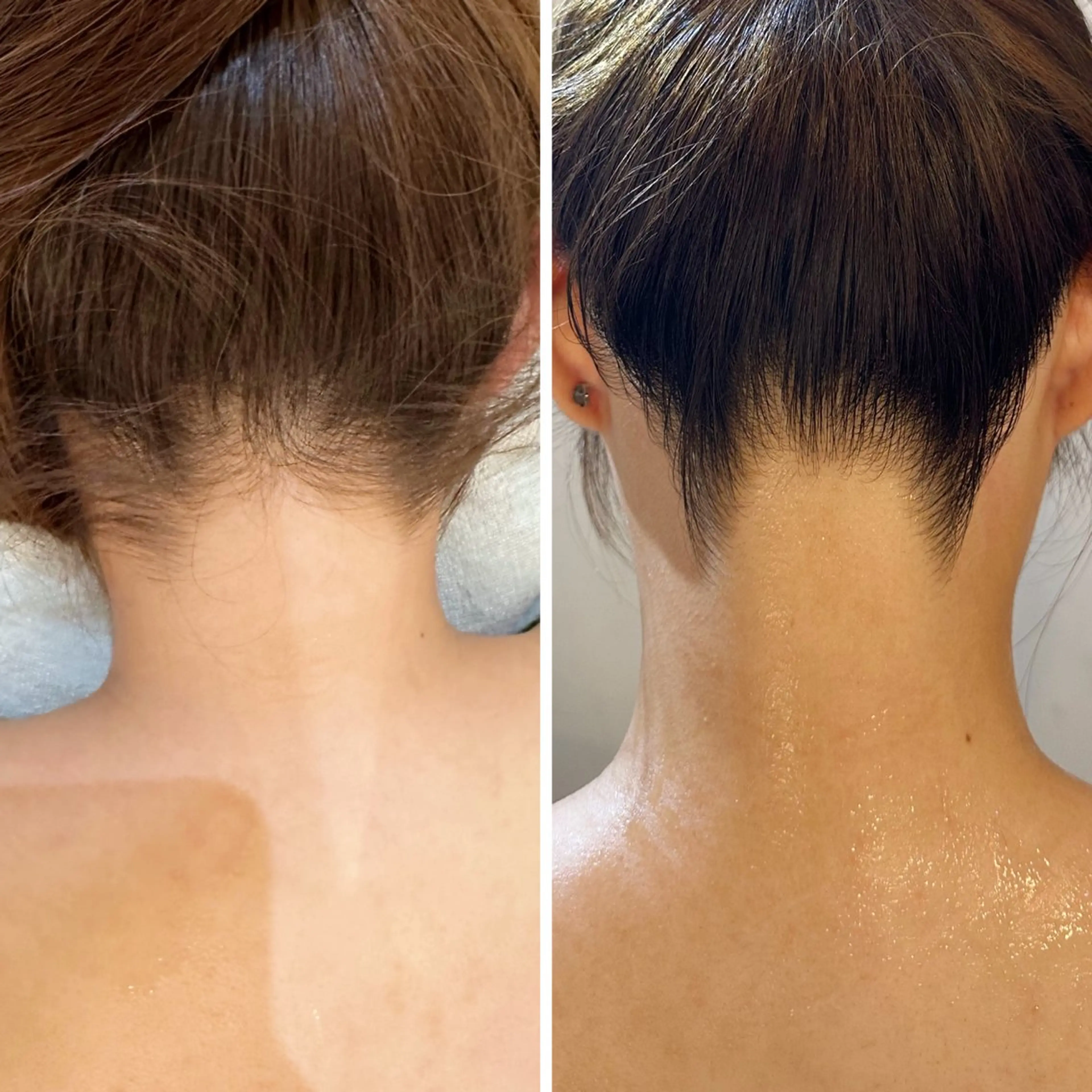 脱毛 うなじ脱毛/美肌脱毛 LABELのエステ・リラクイメージ