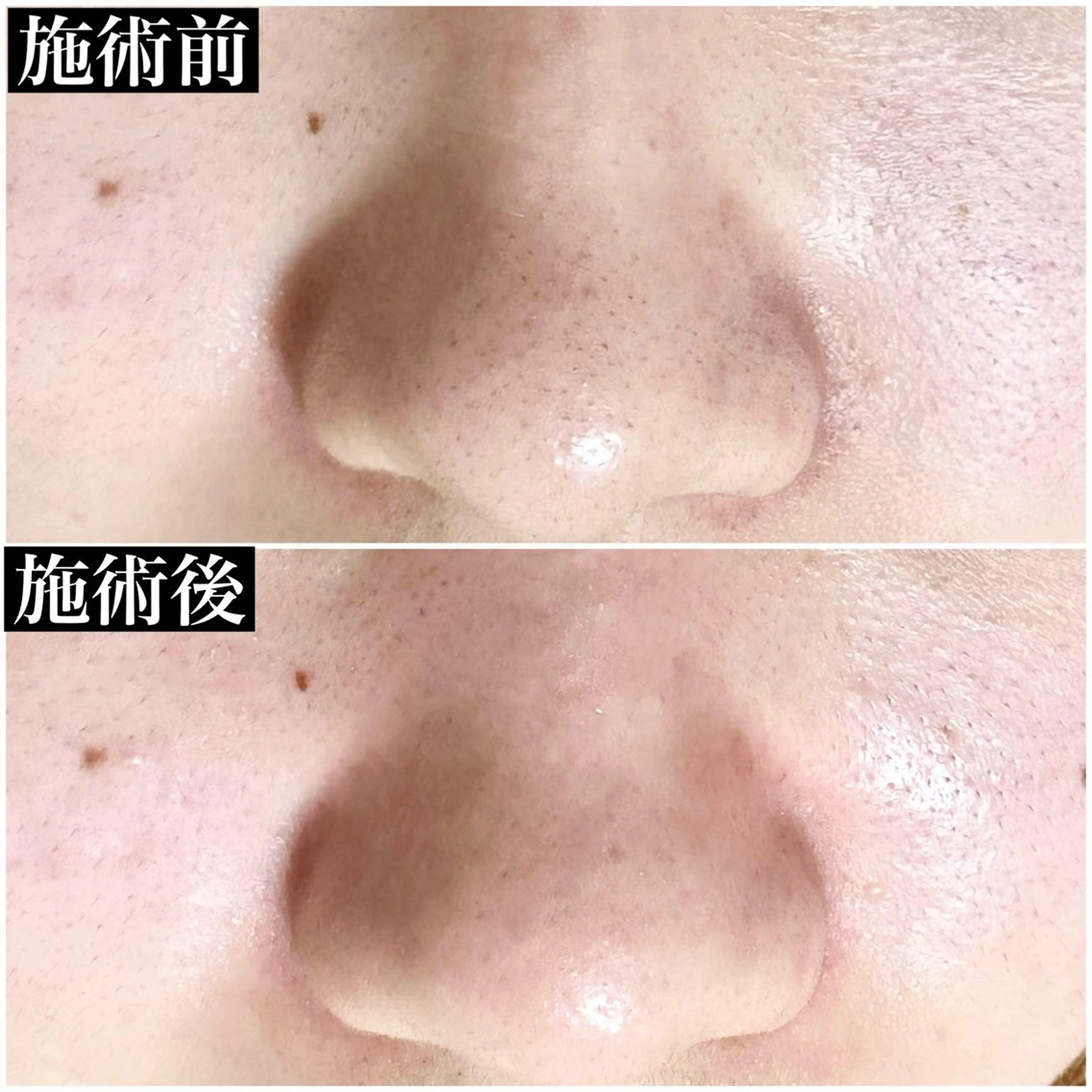 U eyes ちかのマツエク・マツパデザイン