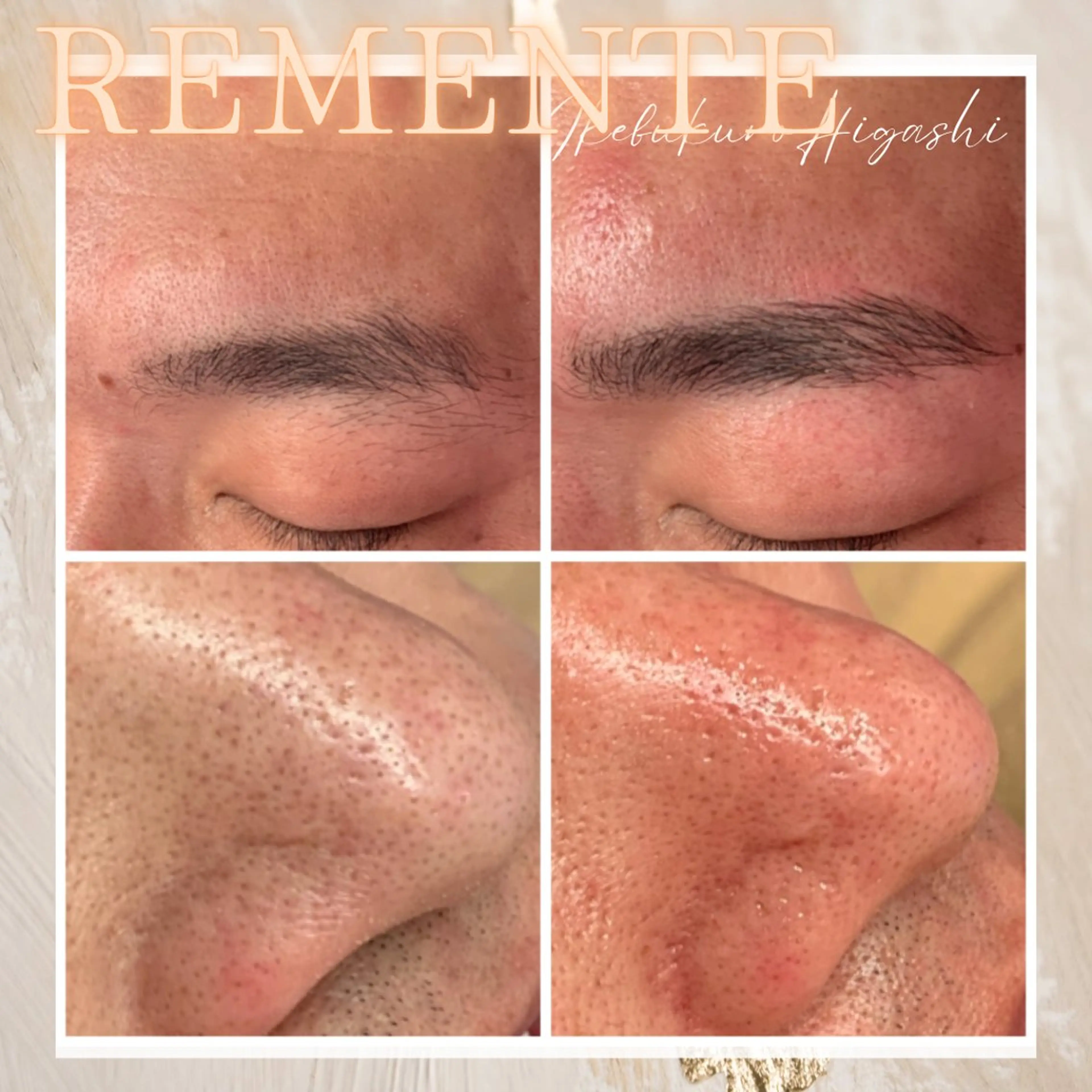 【口コミ限定半額以下に🌹】ハイドラフェイシャル&ハリウッドブロウリフト同時施術で毛穴と眉毛を一緒にケア✨の写真