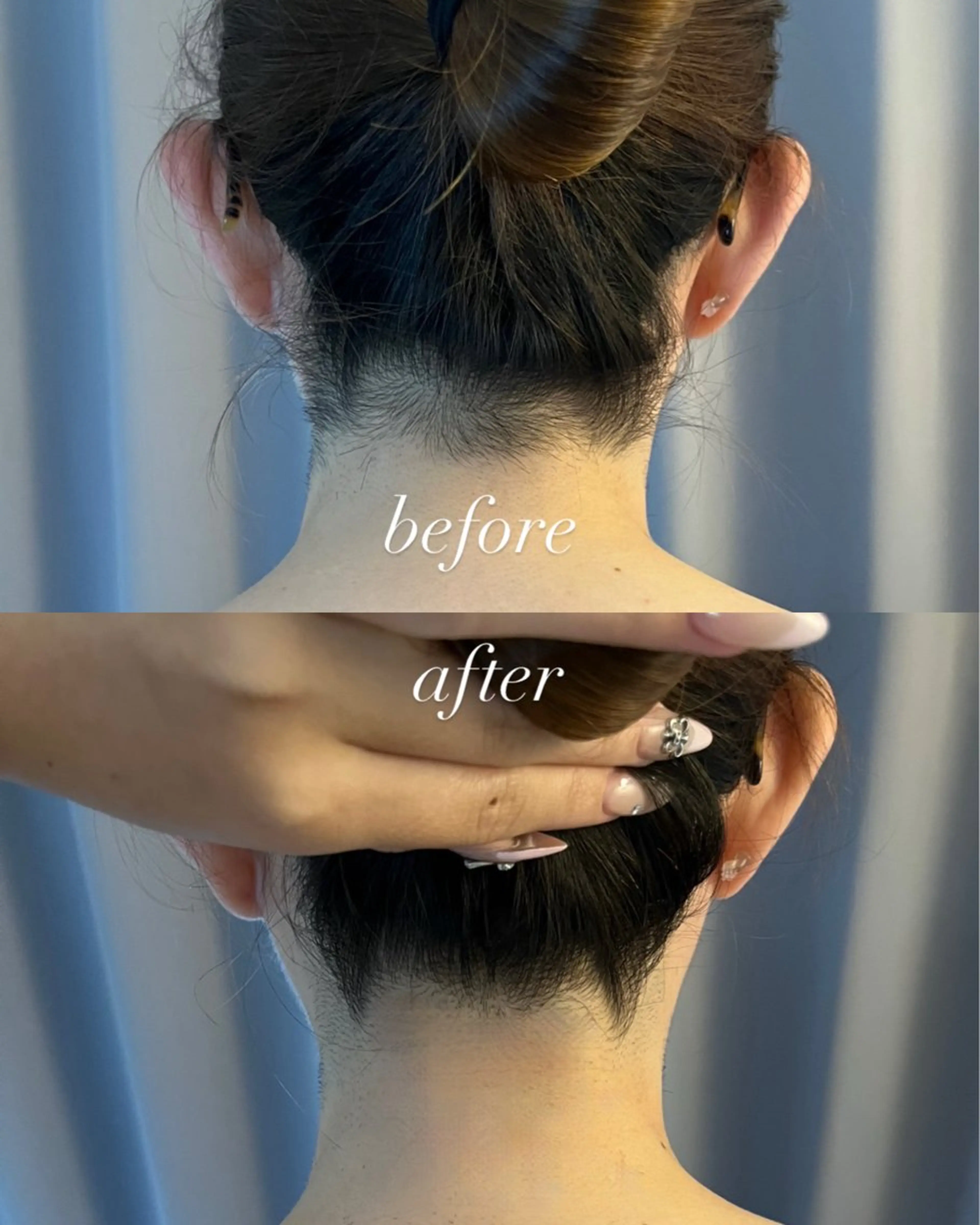 うなじ脱毛/美肌脱毛 LABELのエステ・リラクイメージ