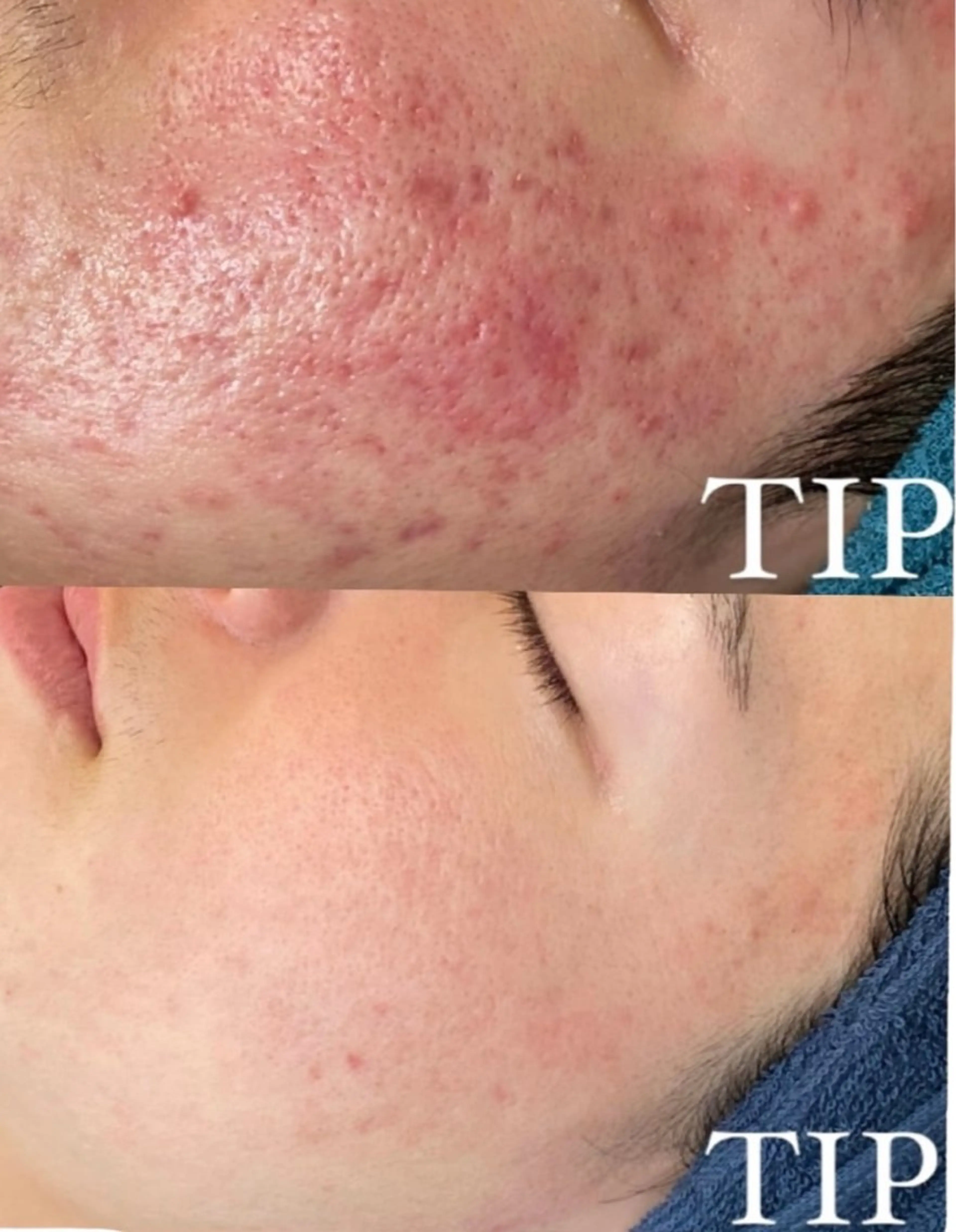 エステ Ellebeauty relaxationのエステ・リラクイメージ