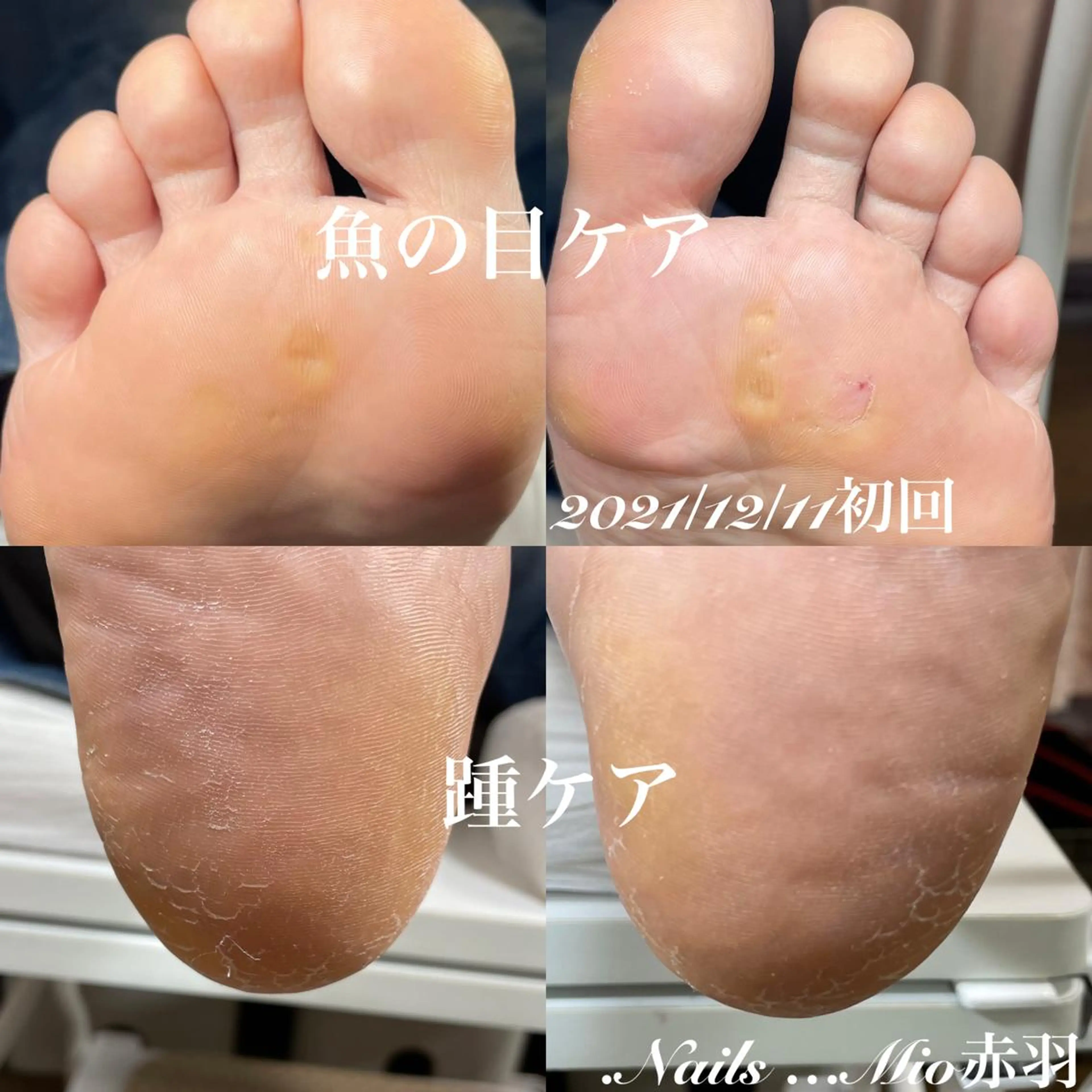 ネイル フットネイル .Nails Mio 赤羽西ネイルサロンのネイルデザイン