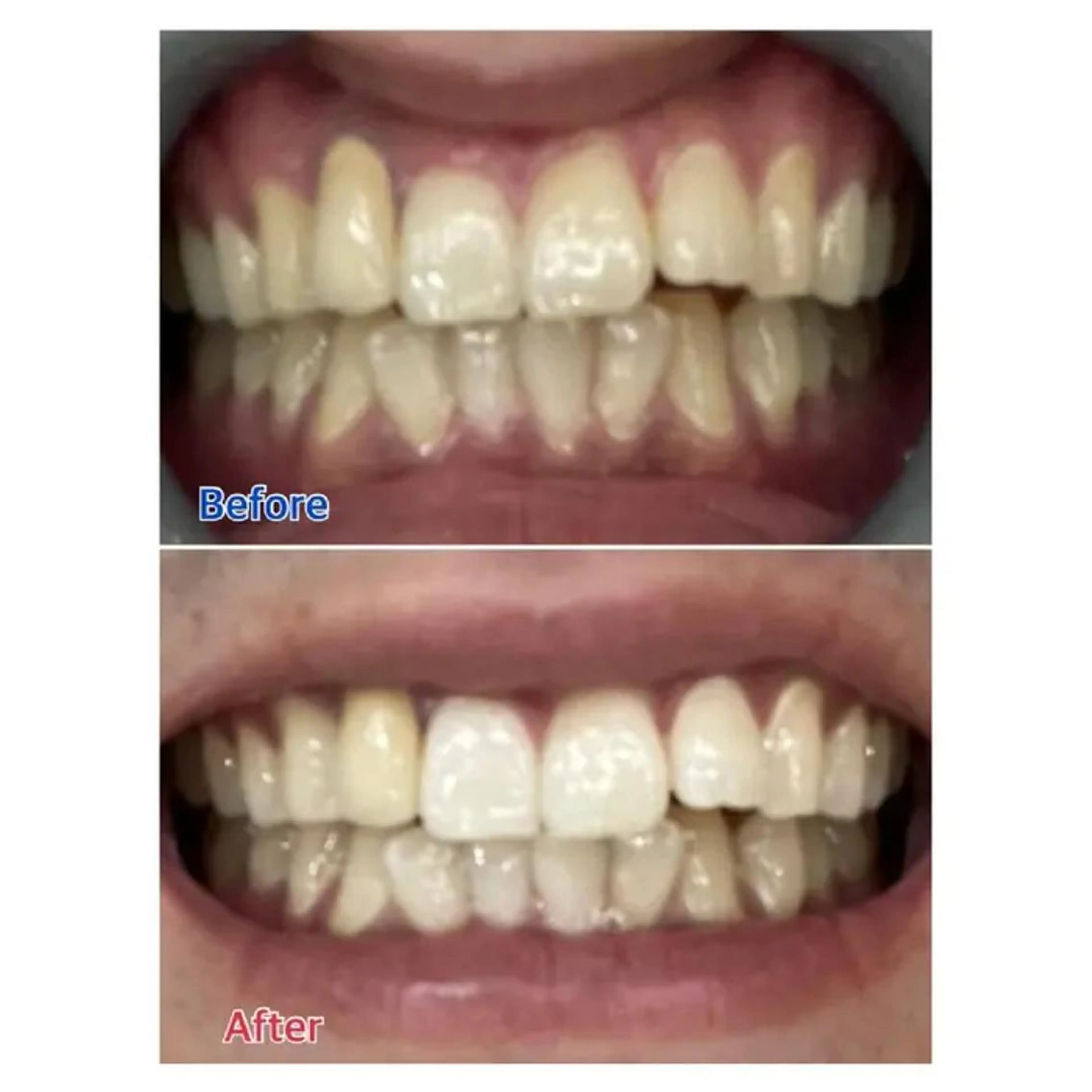 M渋谷店所属・M渋谷 ホワイトニングのエステ・リラクイメージ