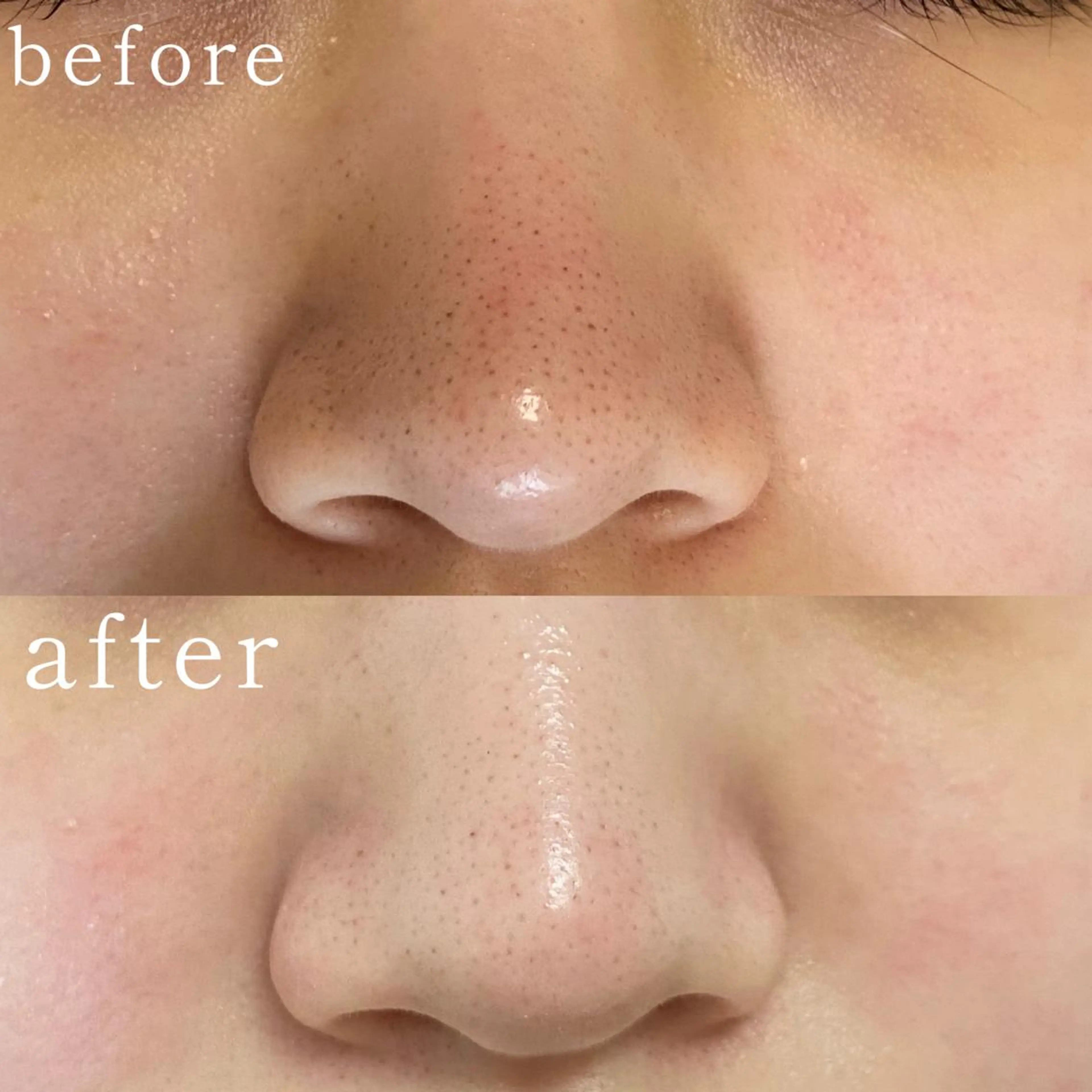 毛穴専門サロン　フルール所属・フルールFululu 自由が丘のエステ・リラクイメージ