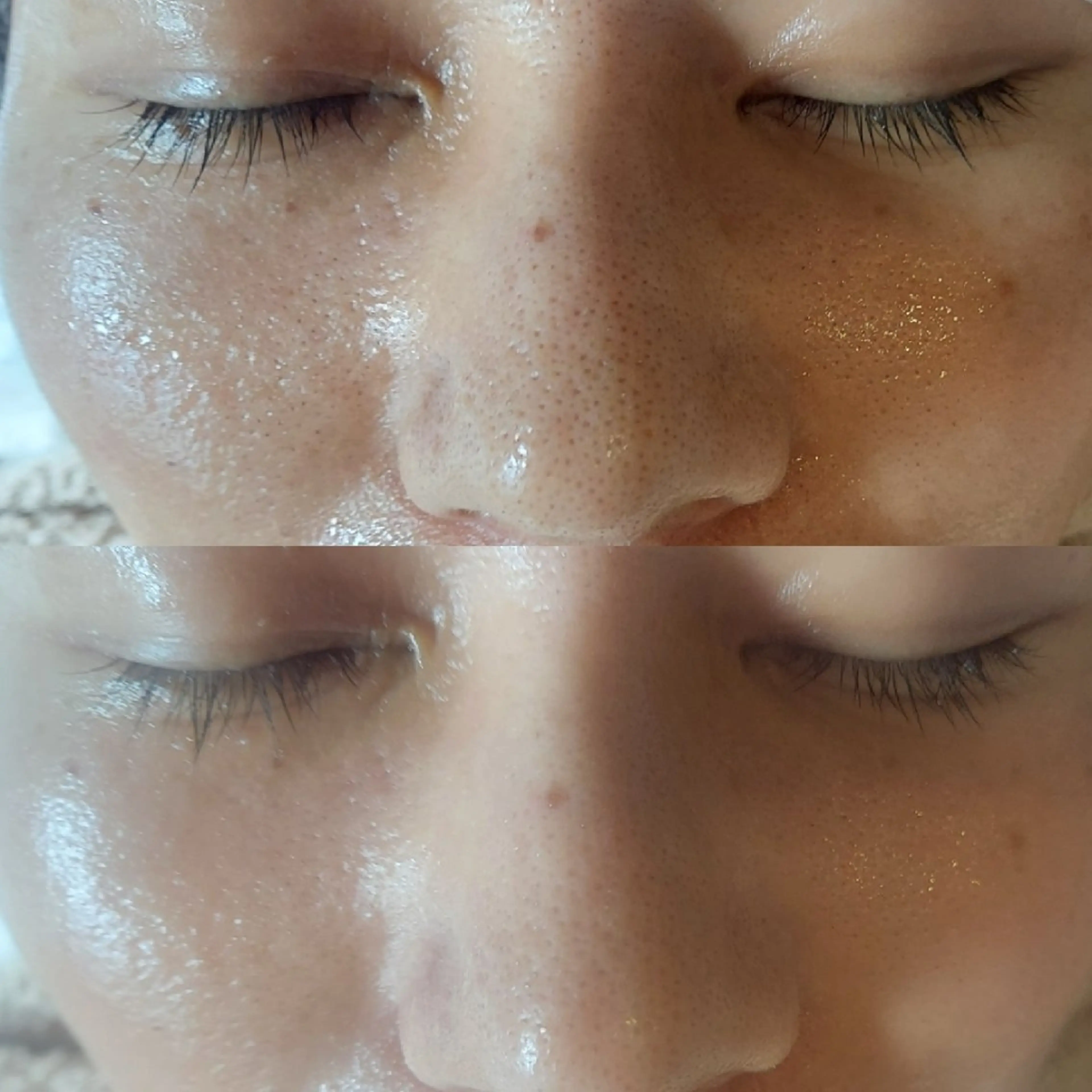 時短メニュー新機器マイクロカレントの写真