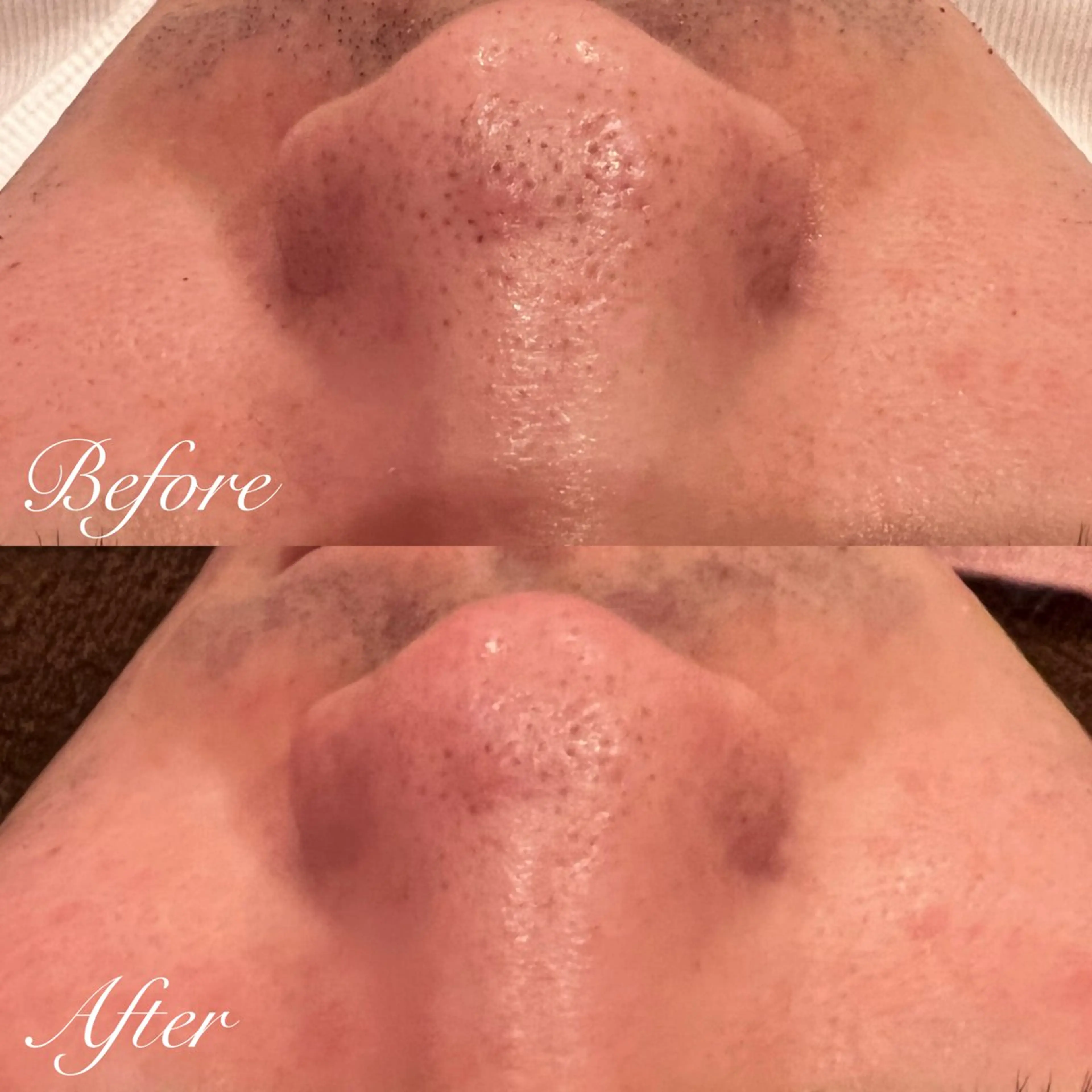 エステ シミ🩷ニキビ専門店 Matteo🎀✨のエステ・リラクイメージ