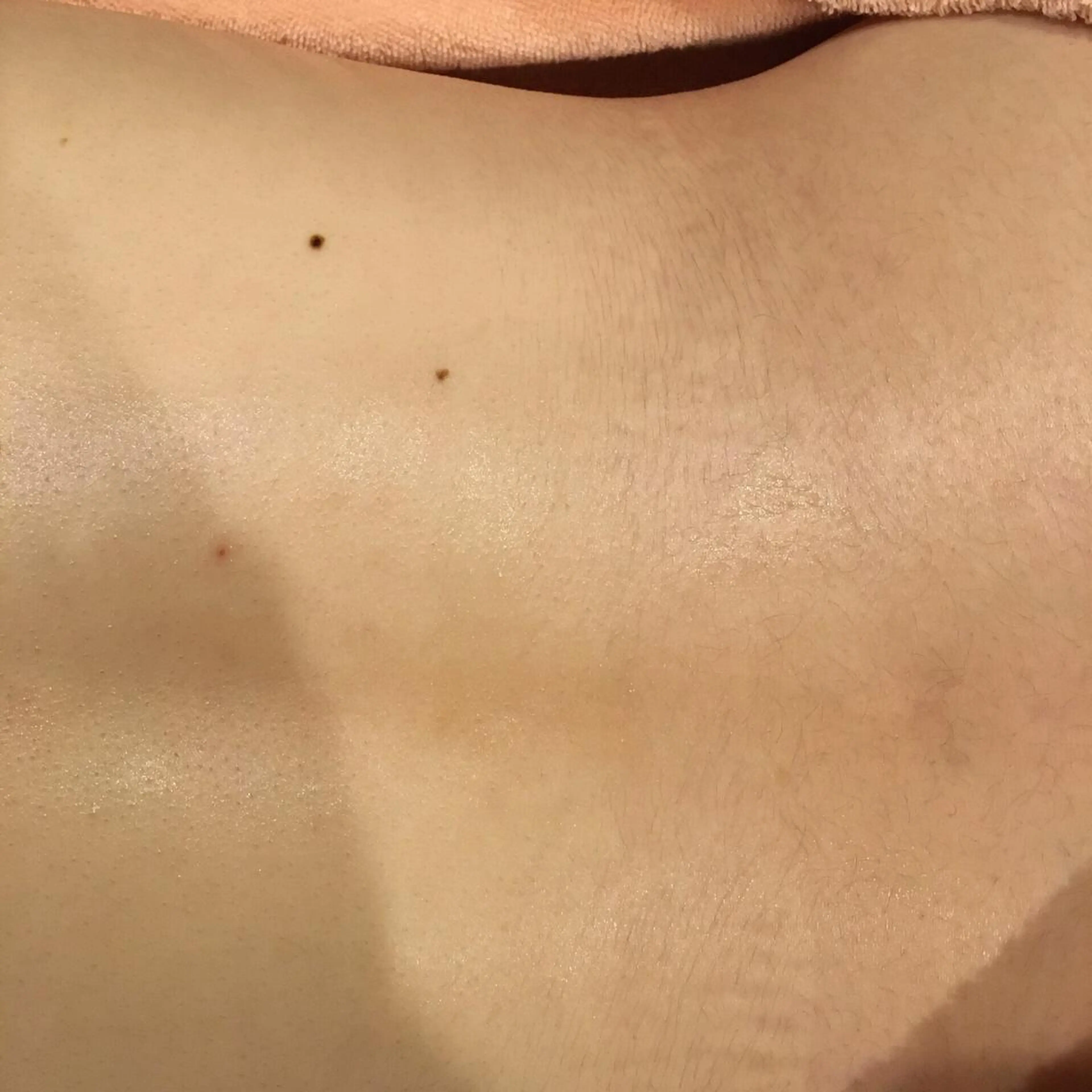 脱毛 美肌脱毛専門サロン Dione栄店のエステ・リラクイメージ