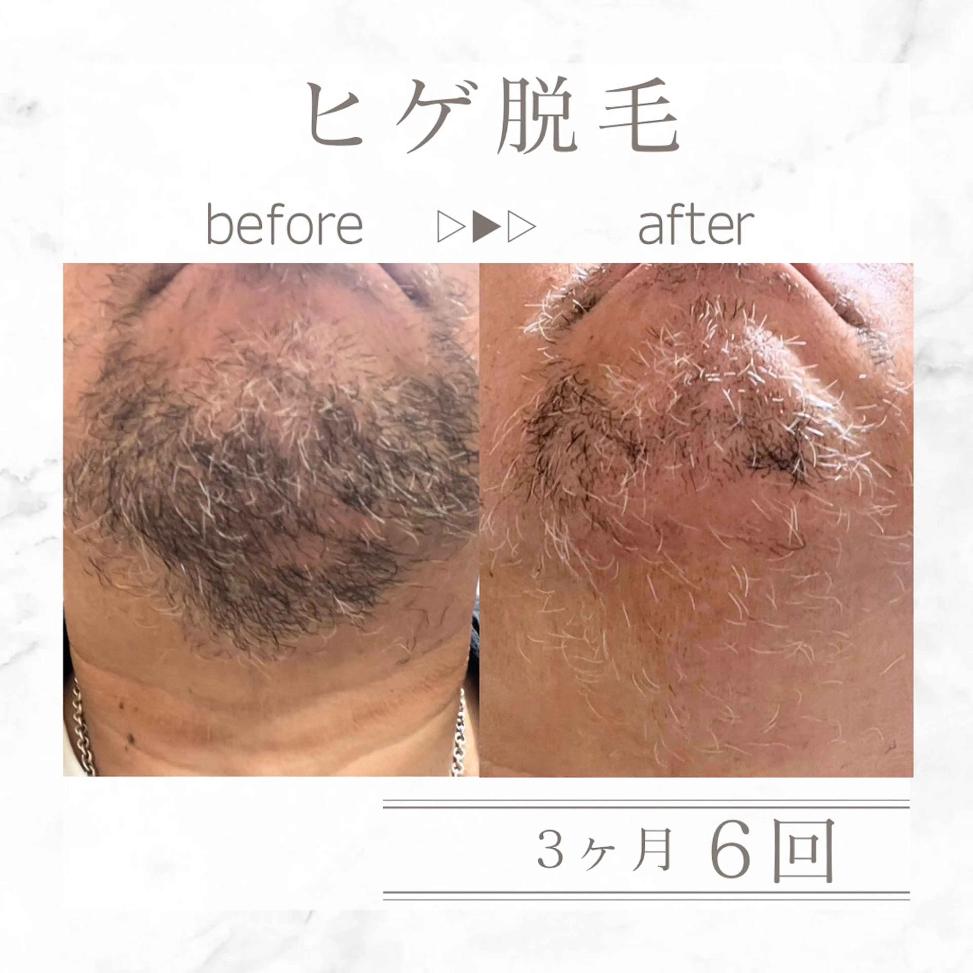 メンズ 脱毛 エステサロンNarcis〜ナルシス〜所属・脱毛&痩身エステ Narcisのエステ・リラクイメージ